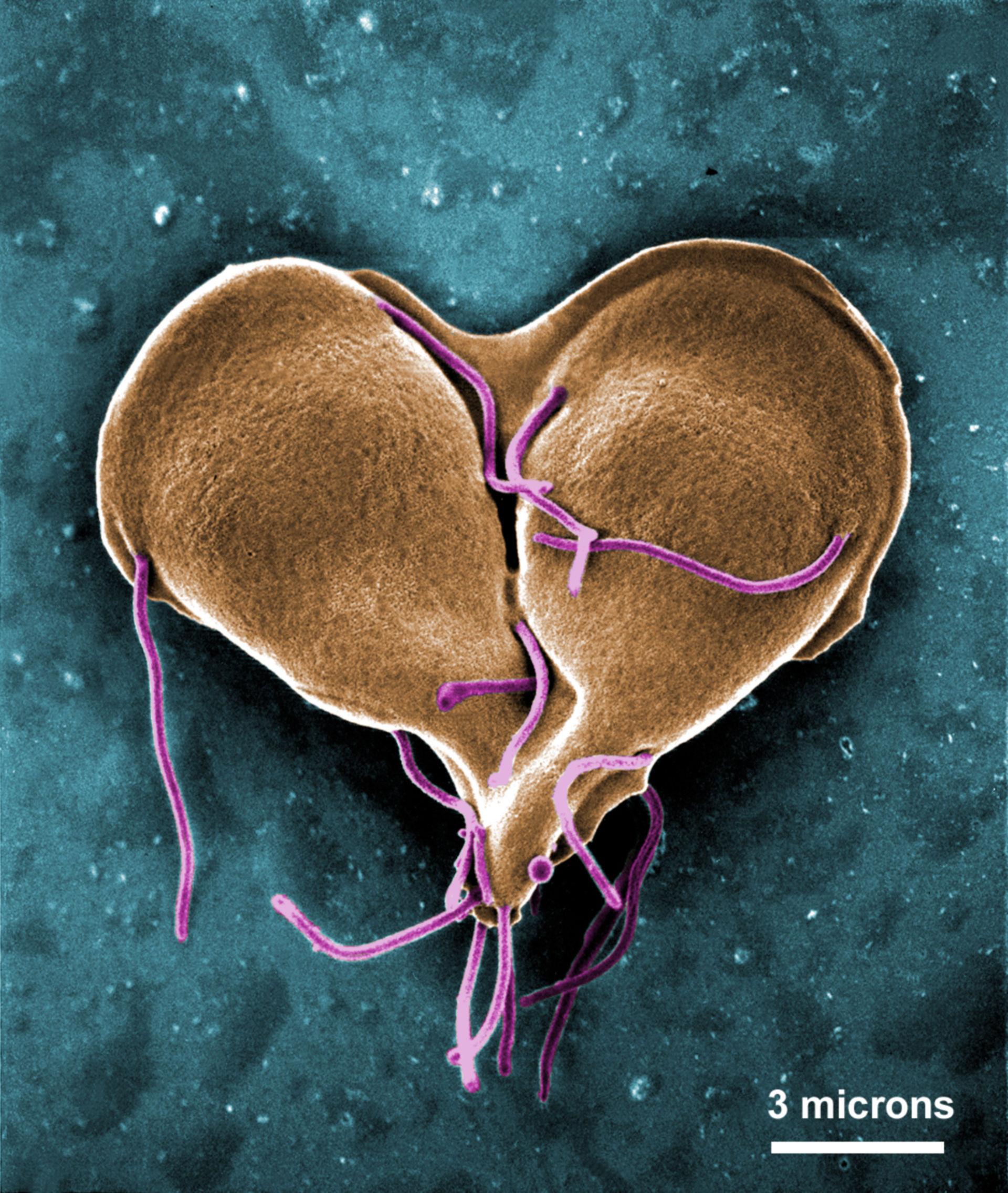 Giardia lamblia während der Zellteilung (REM)