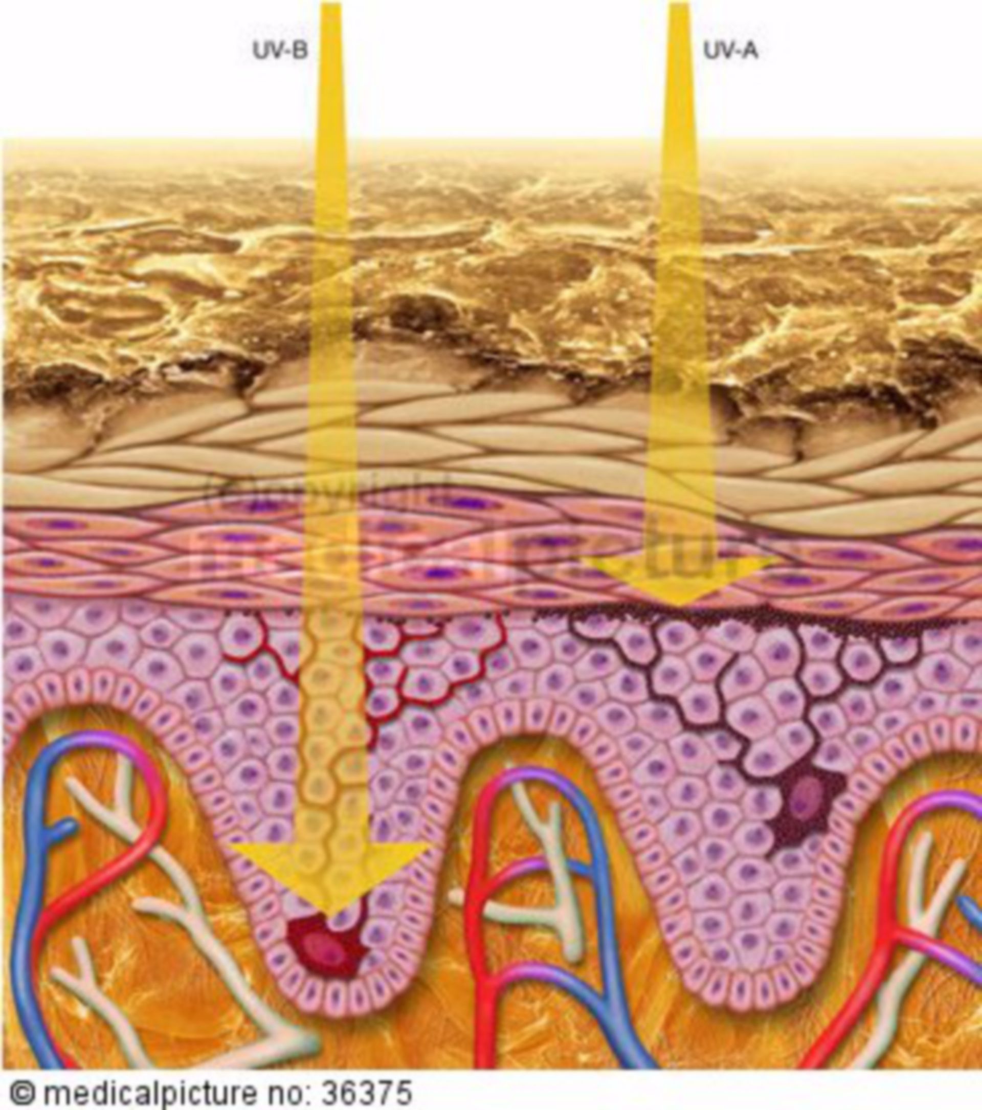  Tiefenwirkung von UV-B und UV-A Strahlen in der Haut 
