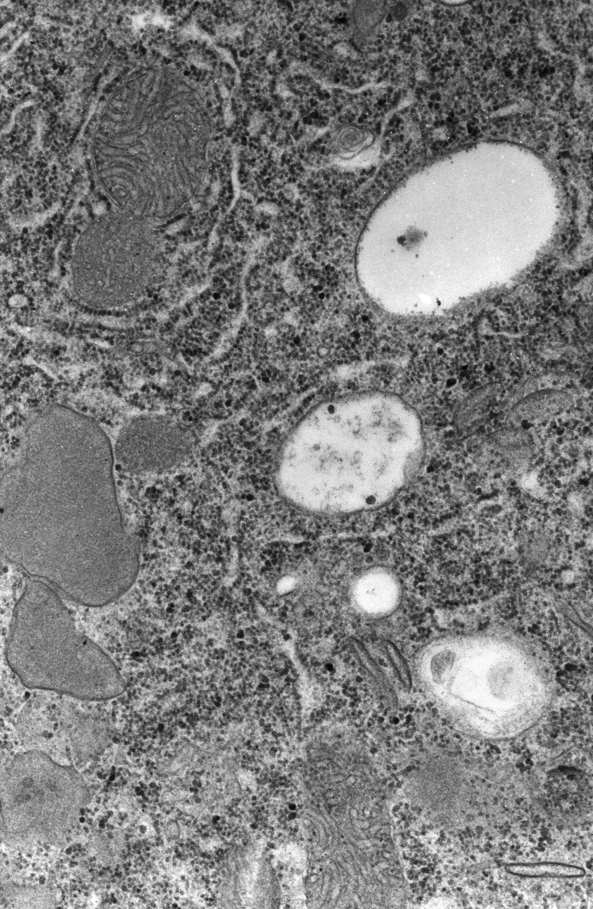 Paramecium caudatum (Glycogen granule) - CIL:39140
