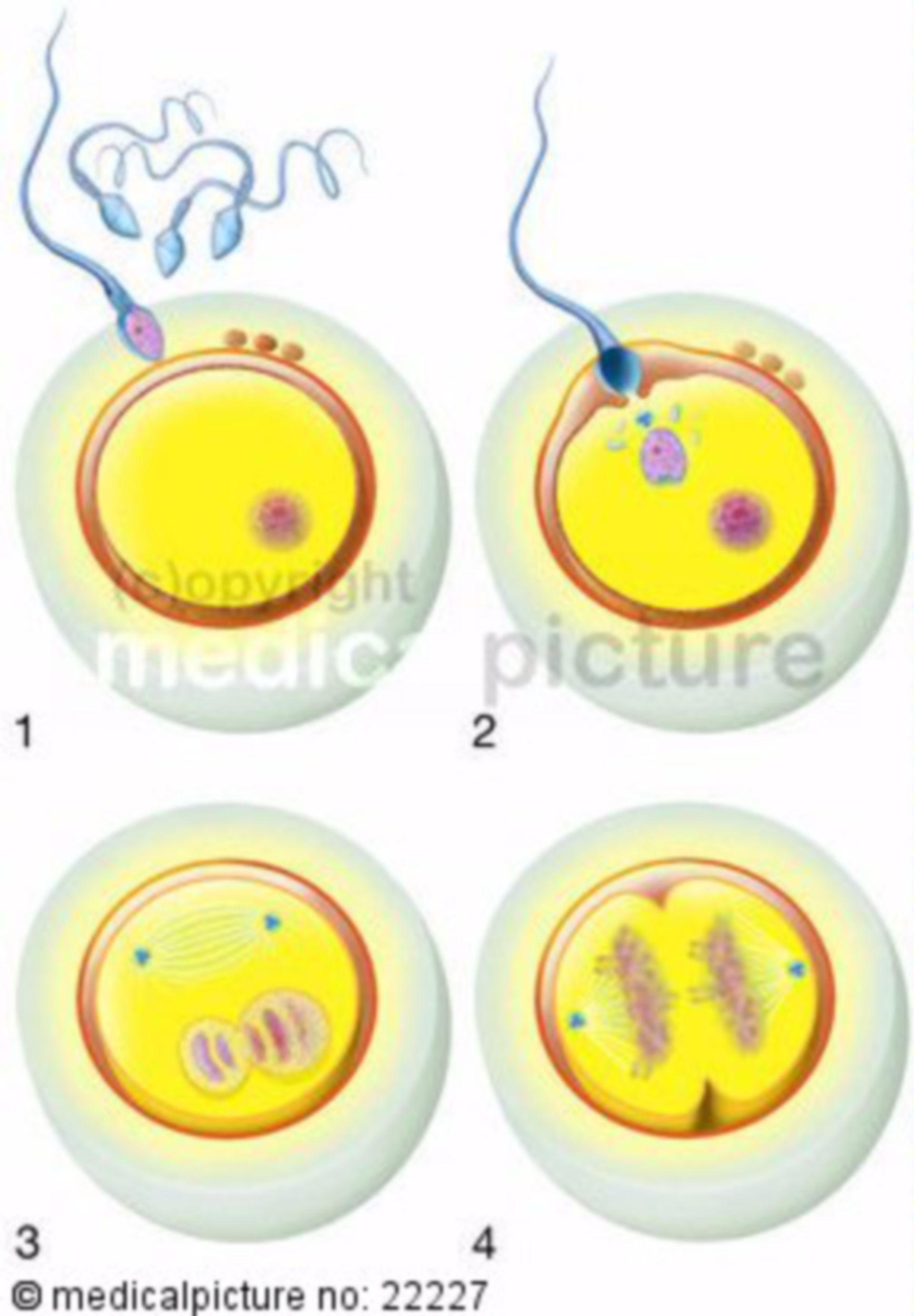Befruchtung einer menschlichen Eizelle durch ein Spermium