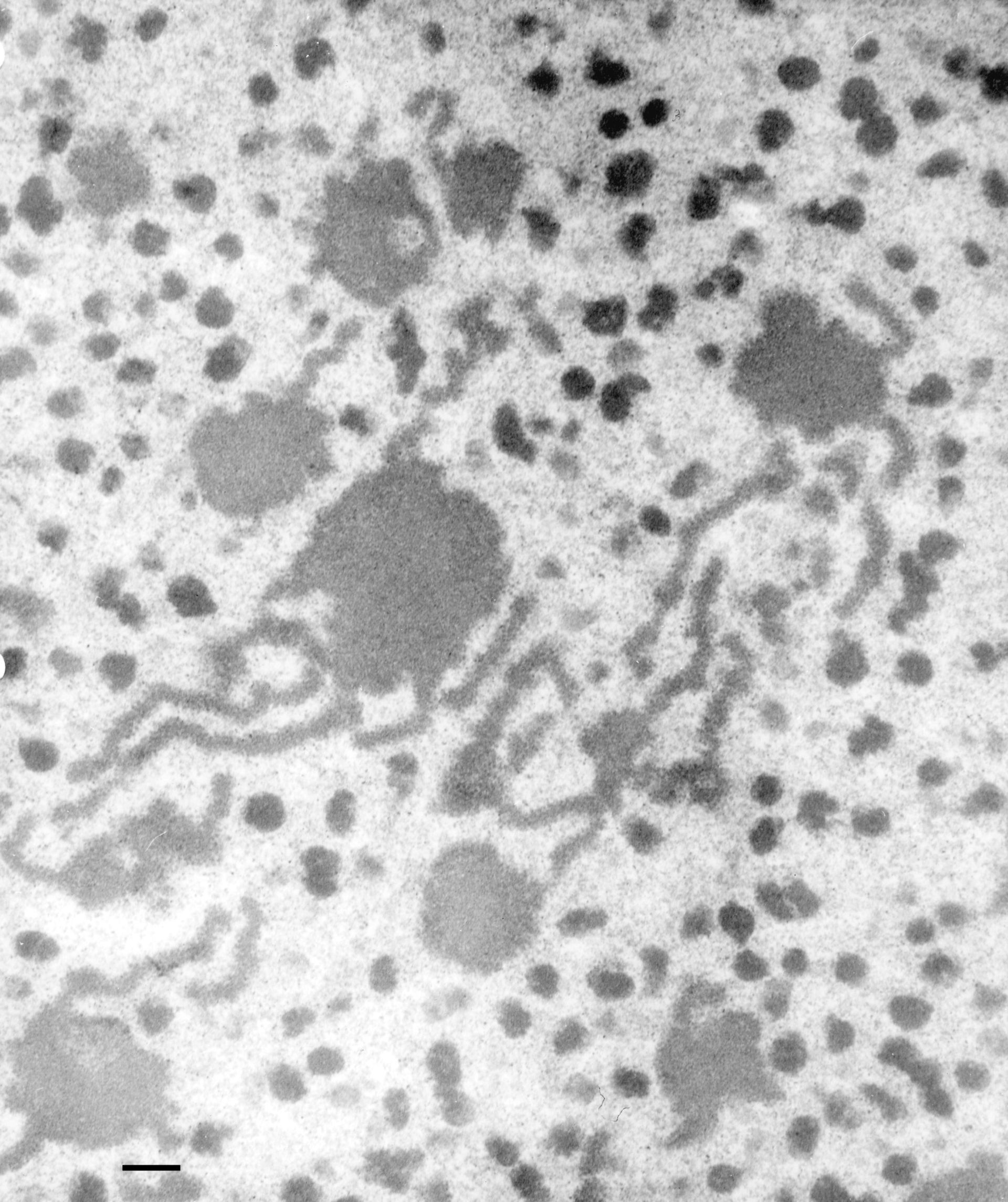 Paramecium multimicronucleatum (Nucleolus) - CIL:36660