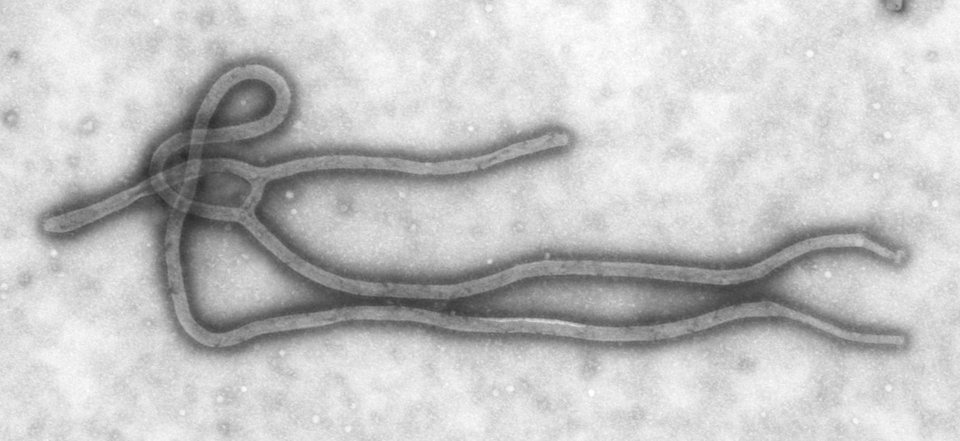 Ebola Virus (TEM)