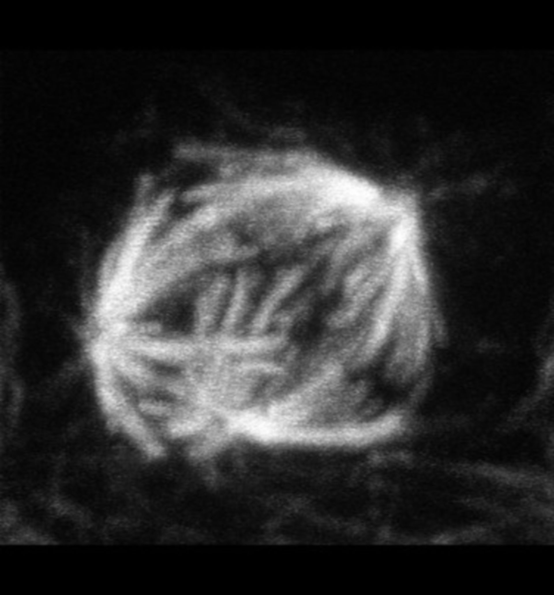 Homo sapiens (Spindle microtubule) - CIL:35481