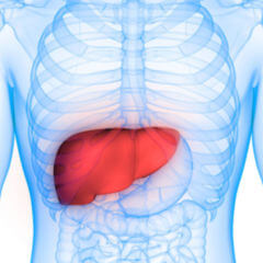 Hepatozelluläres Karzinom - DocCheck Flexikon