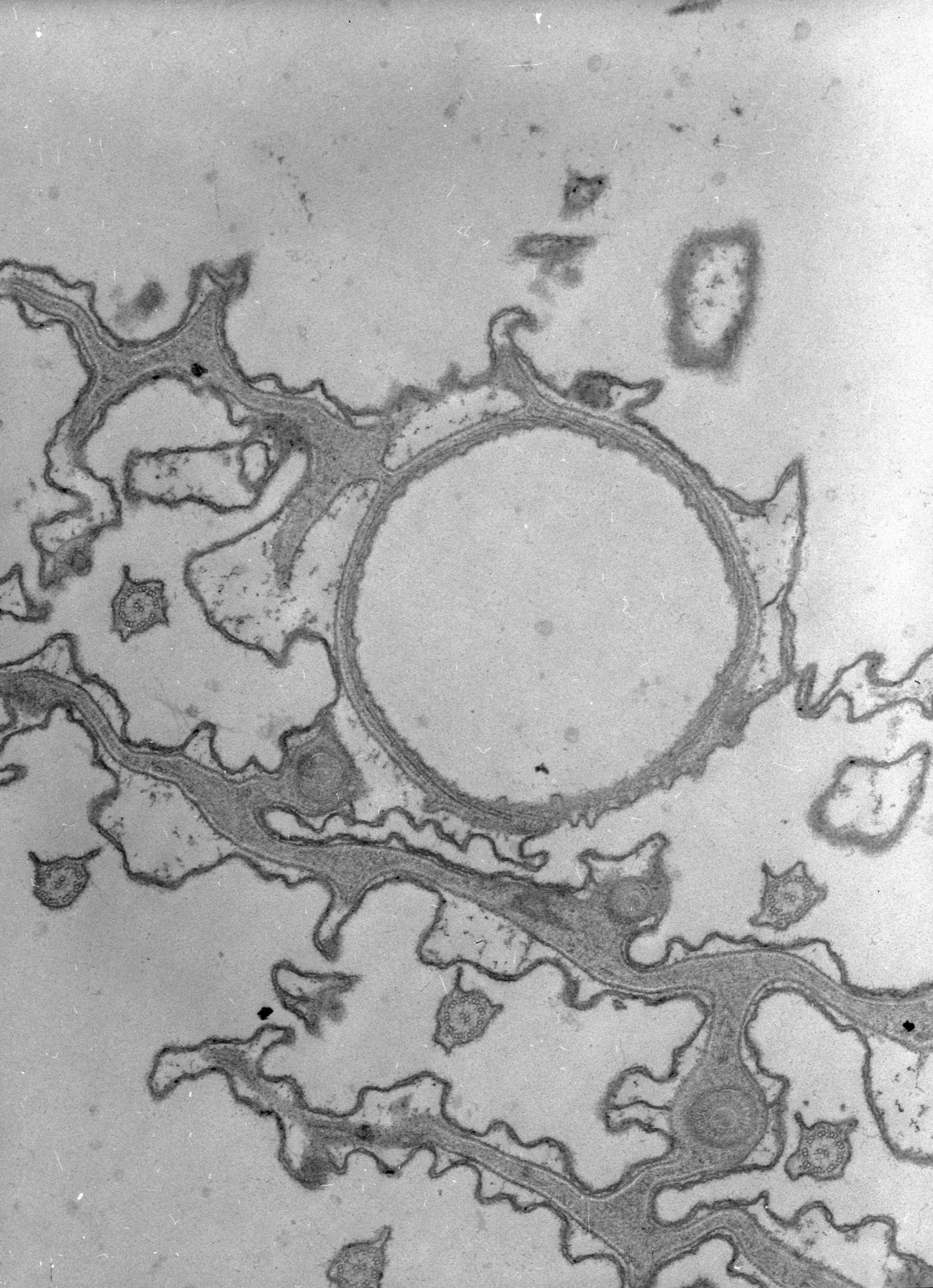 Paramecium caudatum (Cell cortex) - CIL:38894