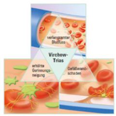 Virchow-Trias - DocCheck Flexikon