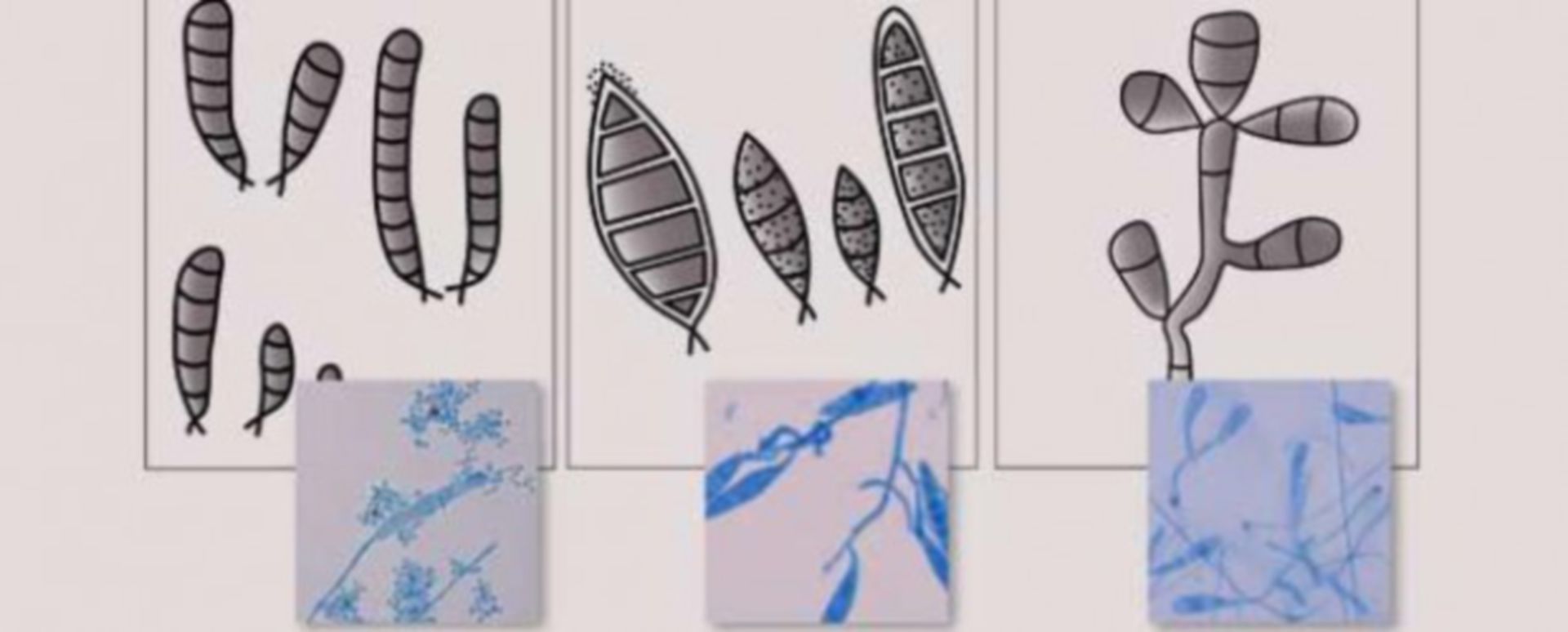Mykologie Dermatophyten und Darmatophytosen DocCheck
