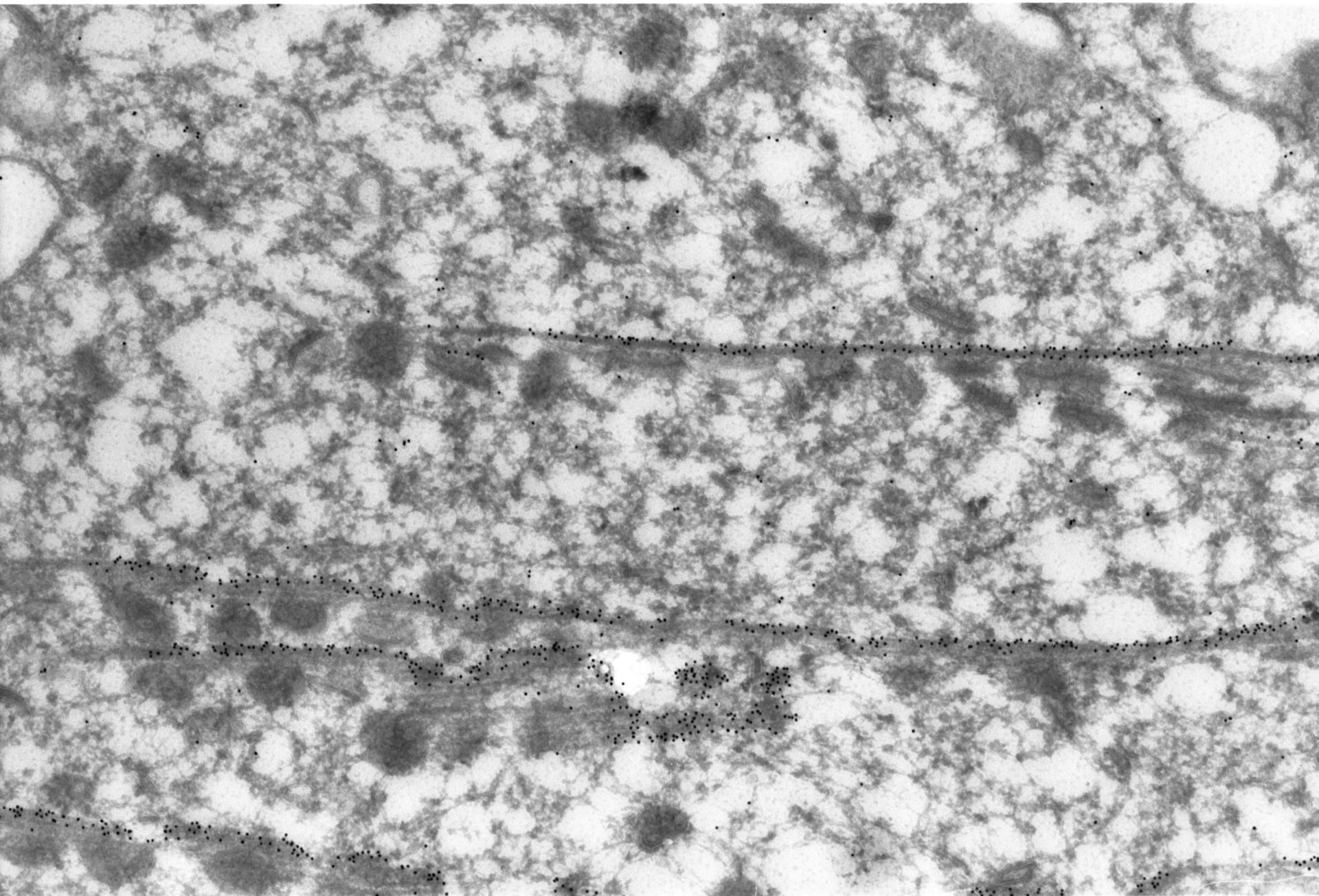 Paramecium tetraurelia (Cortical microtubule) - CIL:1309