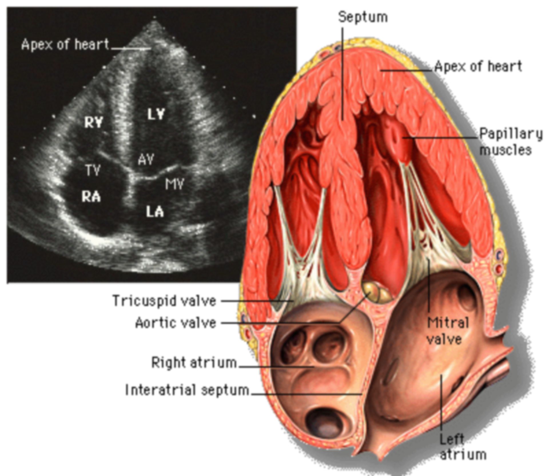 Apikaler 4-Kammer-Blick auf das Herz