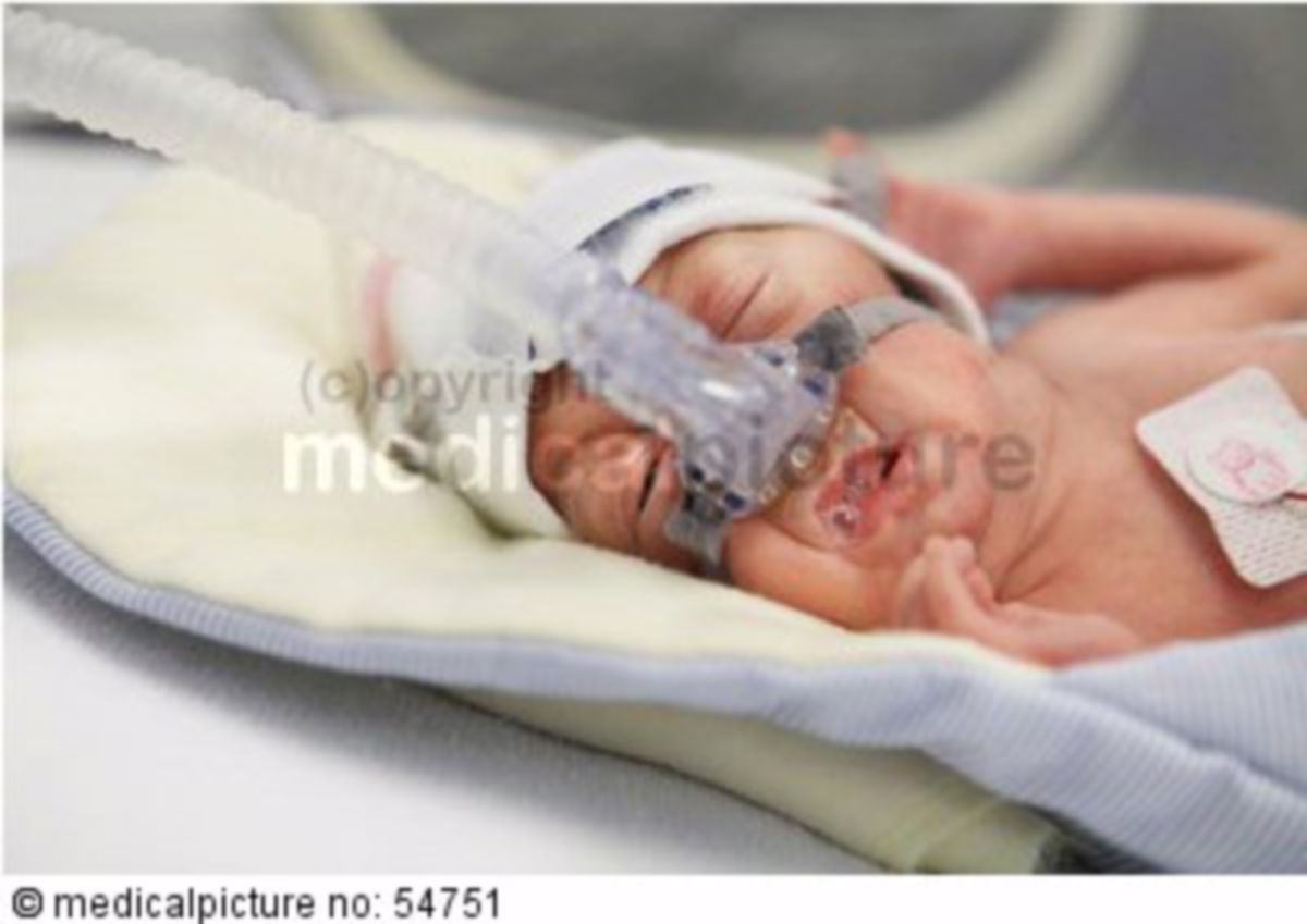 Offener bilder baby bauch Fetalchirurgie: Operation