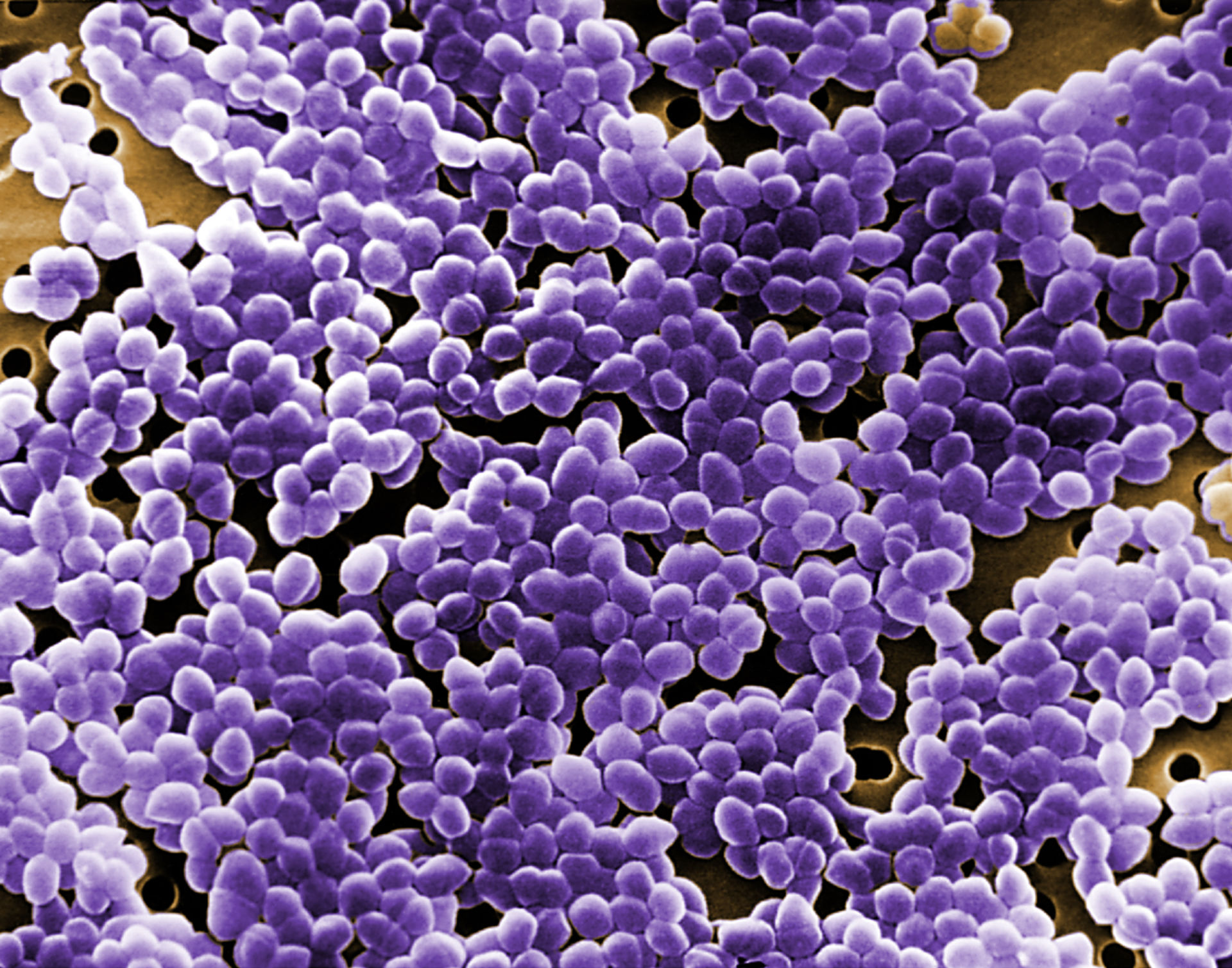 Enterococcus sp. bacteria (REM)