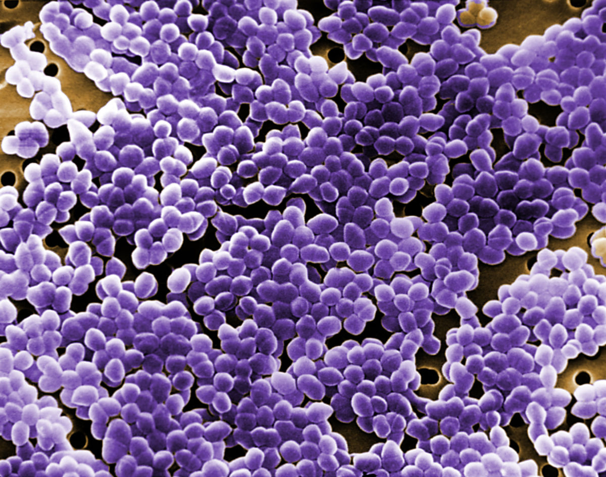Enterococcus sp. bacteria (REM)