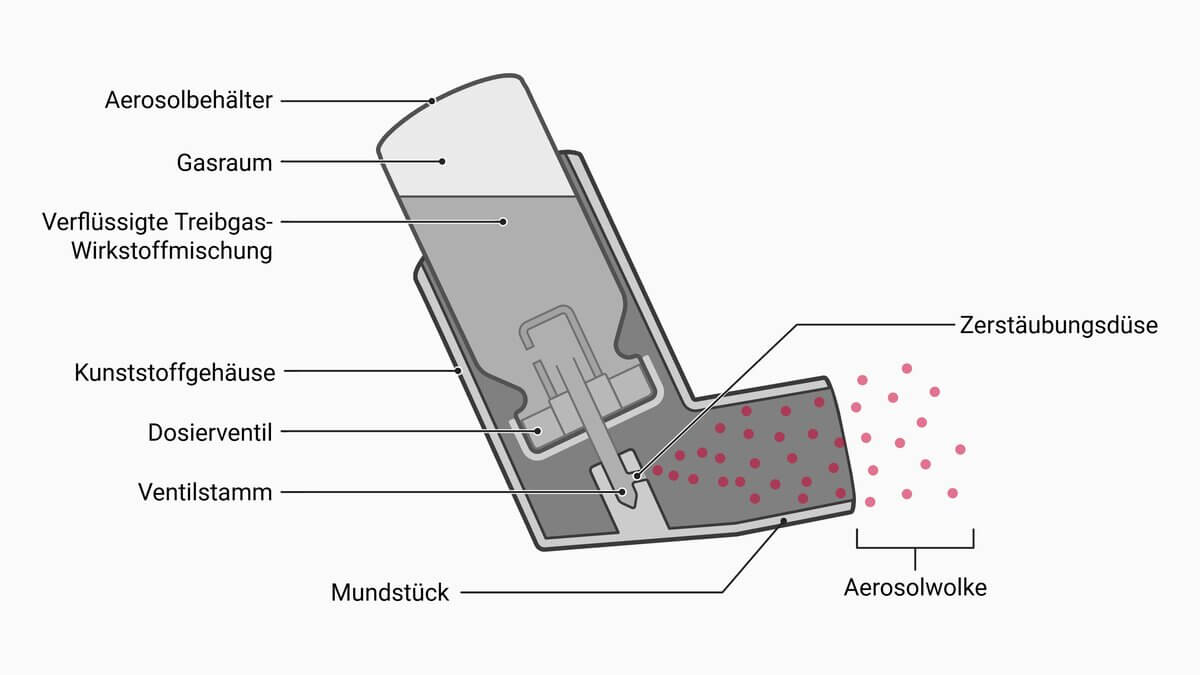 Aufbau eines Dosieraerosols