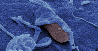 Yersinien (in rot) dringen in die Zellen ein und verursachen schwerwiegende Infektionen. © HZI/Rohde