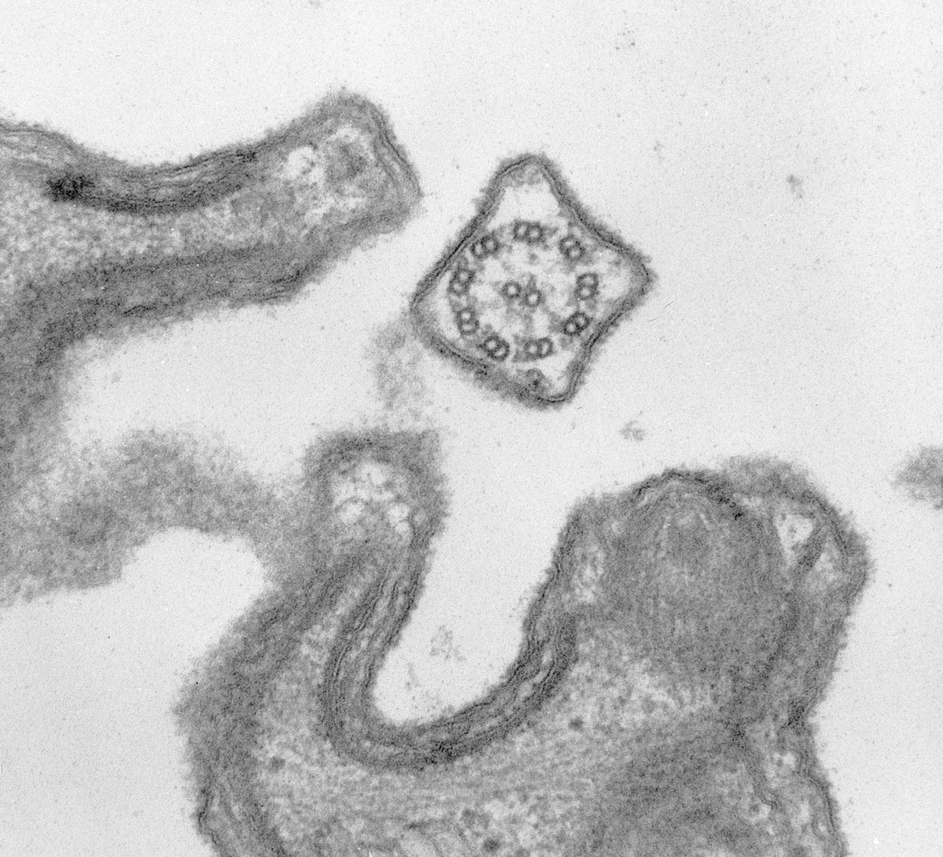 Paramecium caudatum (Glycocalyx) - CIL:38898