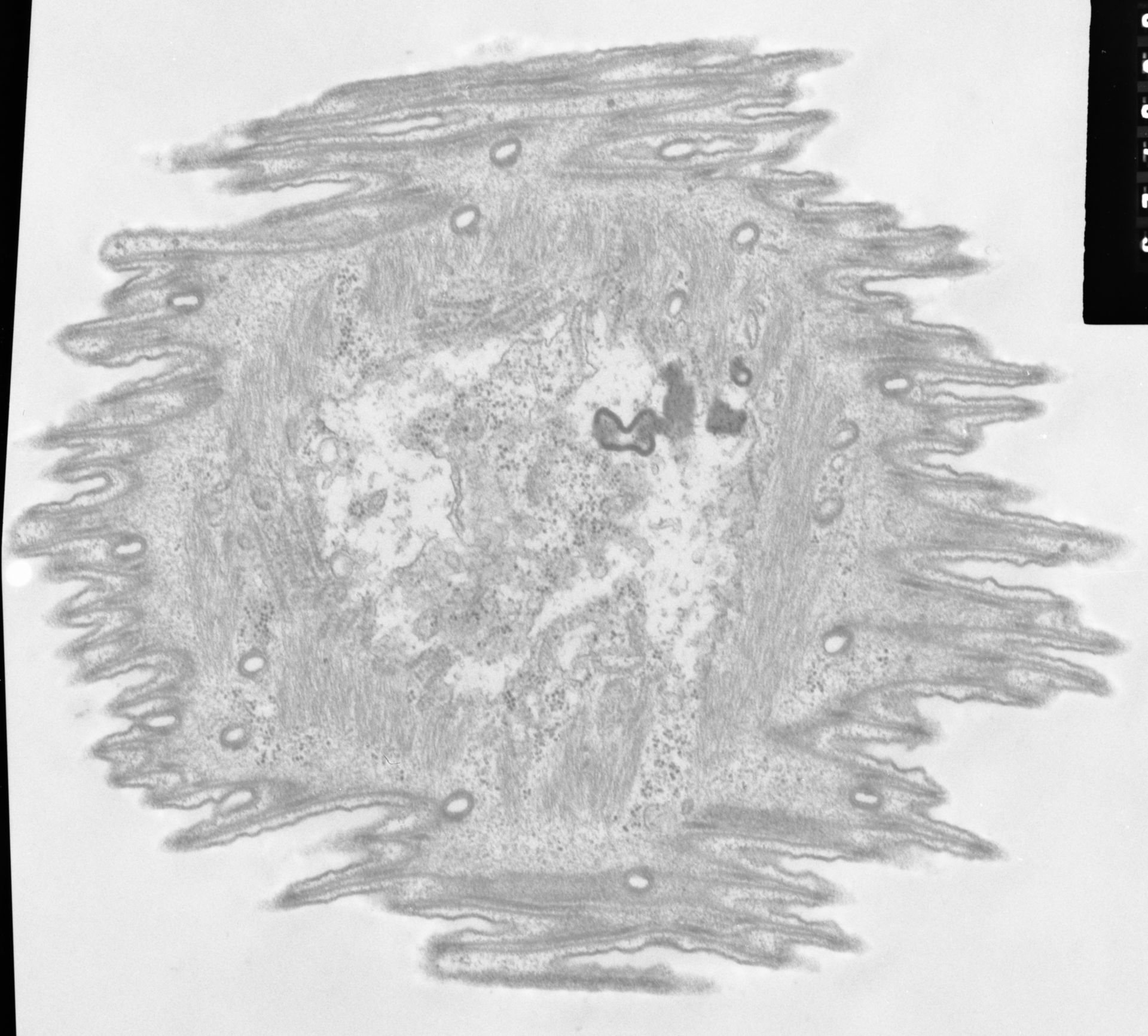 Opercularia coarctata (Clathrin coat of coated pit) - CIL:7331