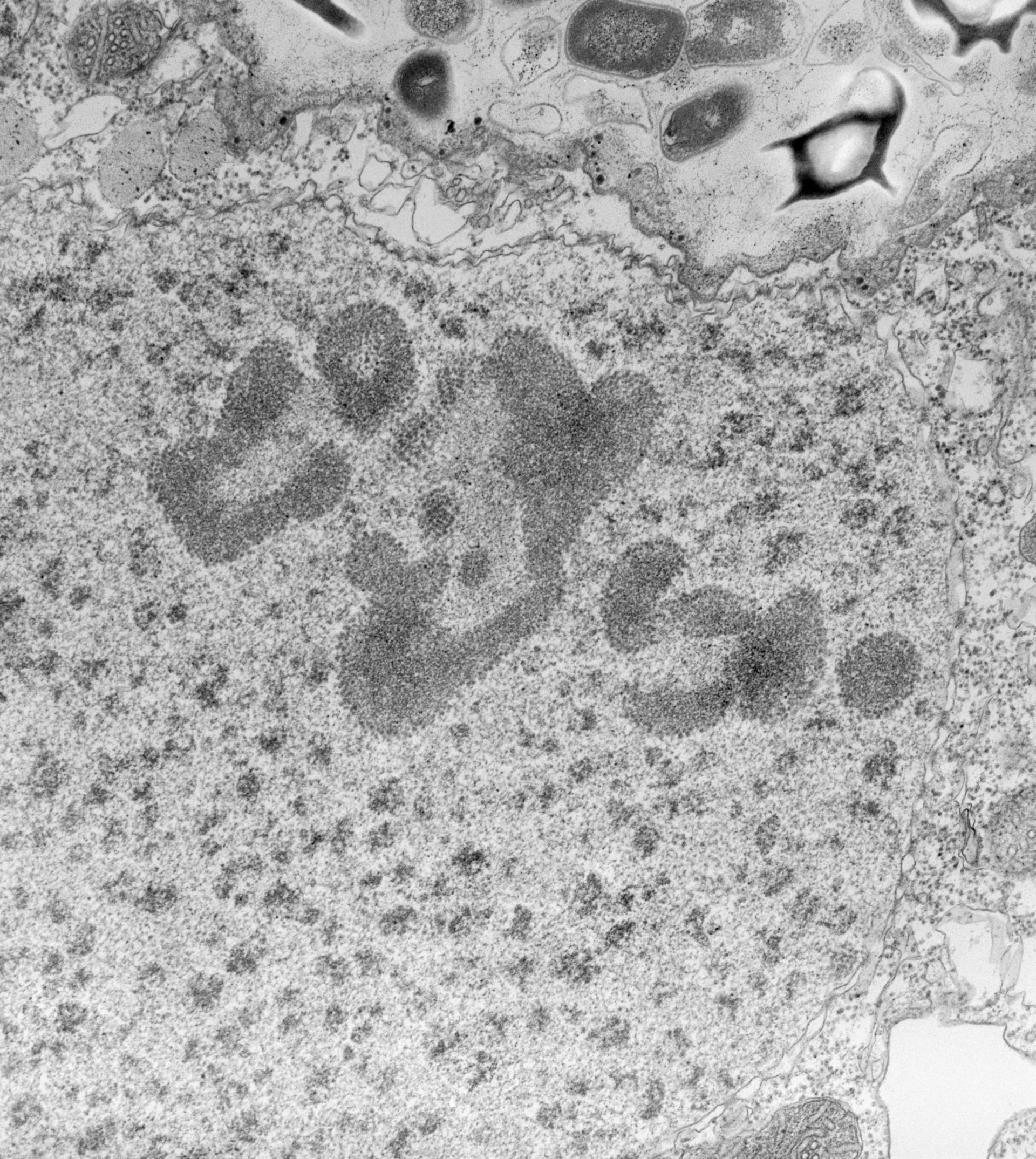 Paramecium caudatum (Nucleolus) - CIL:39205