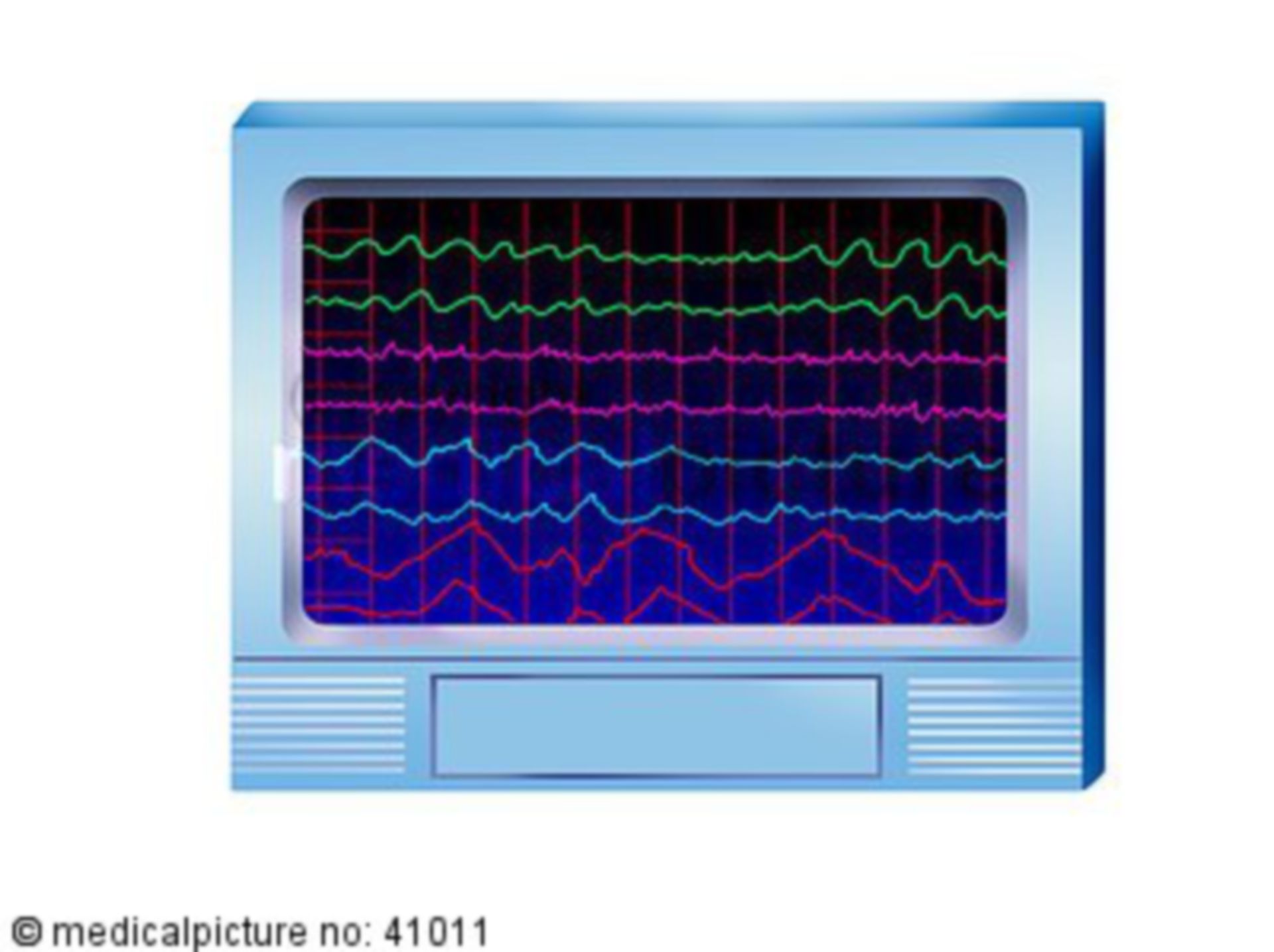 EEG, Wellenprofile, Elektroenzephalographie