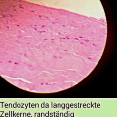 Sehne Doccheck Flexikon