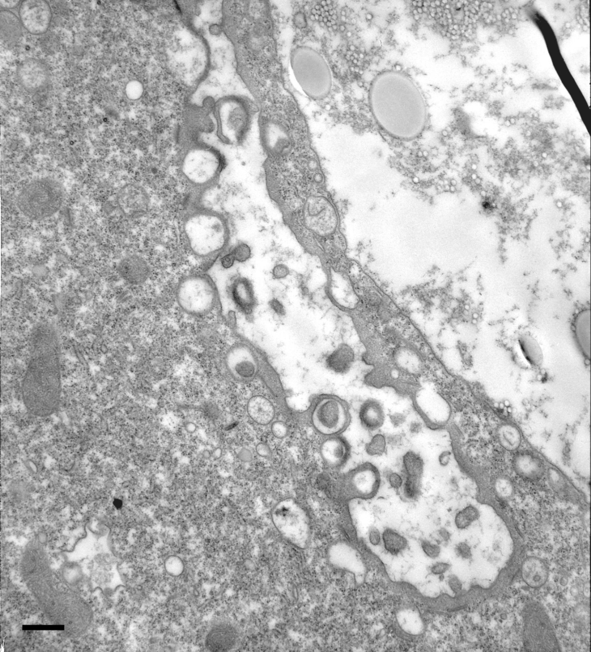 Paramecium multimicronucleatum (Food vacuole) - CIL:36731
