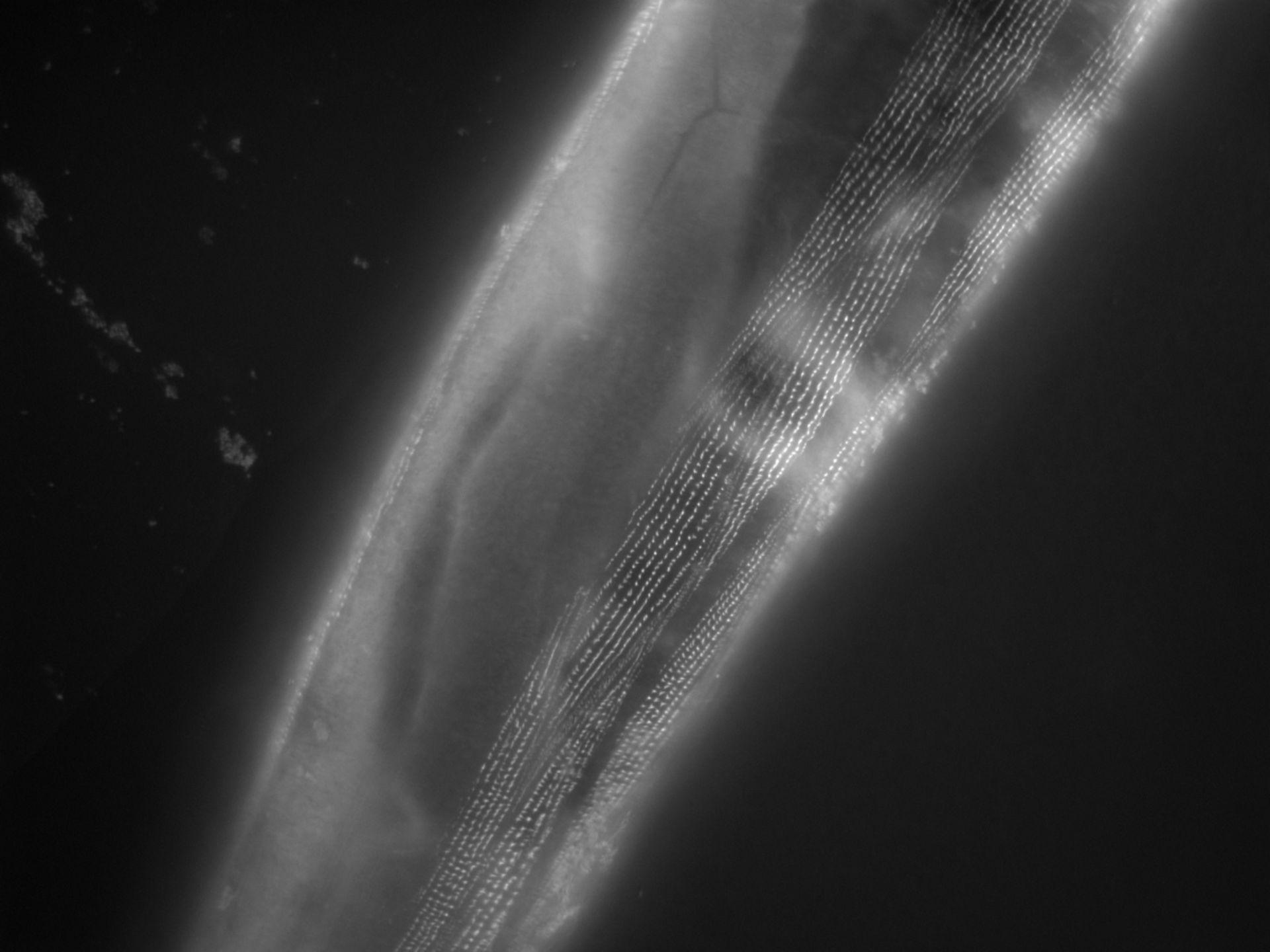 Caenorhabditis elegans (Actin filament) - CIL:1172