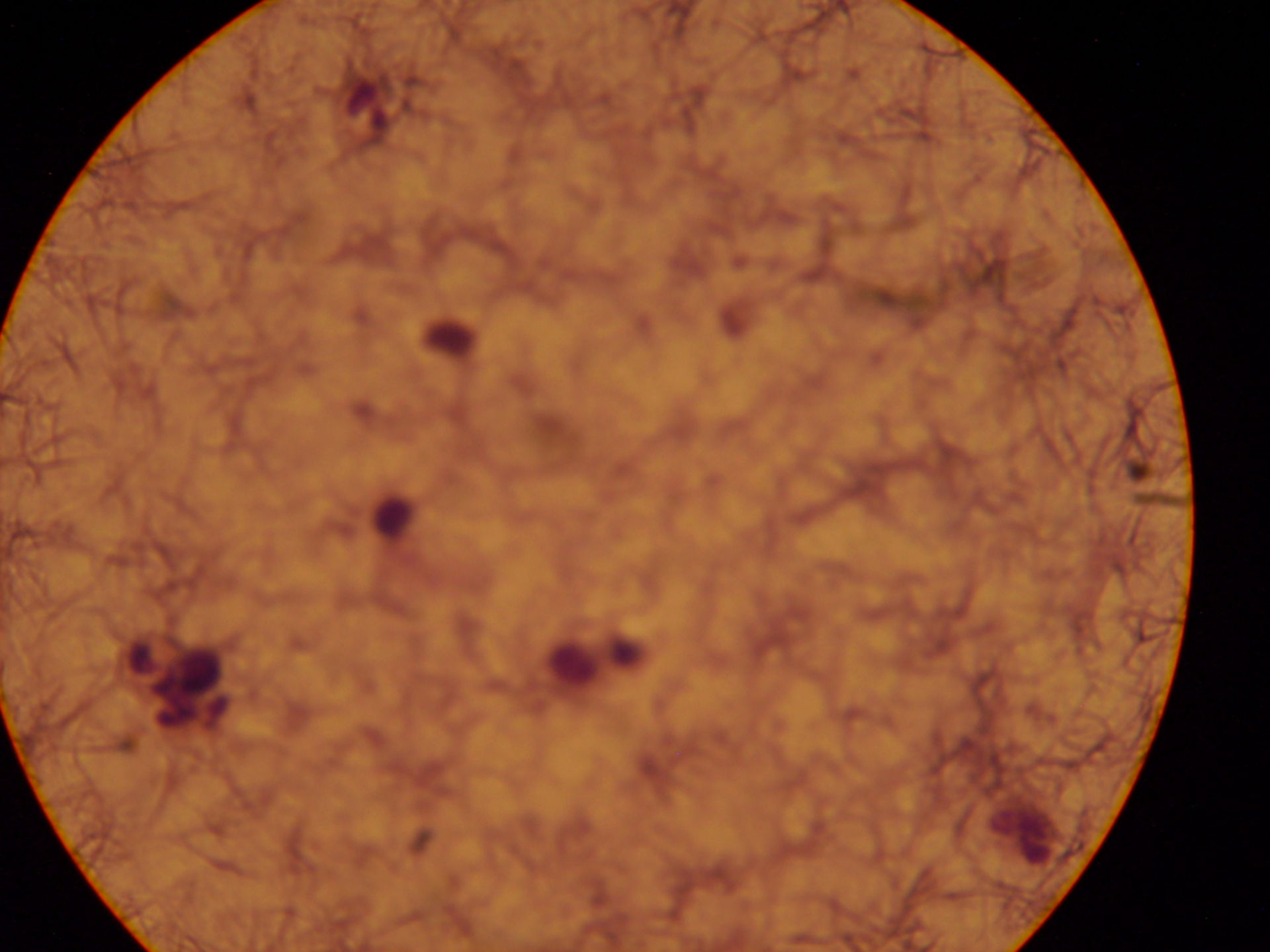 Plasmodium ovale punteggiatura