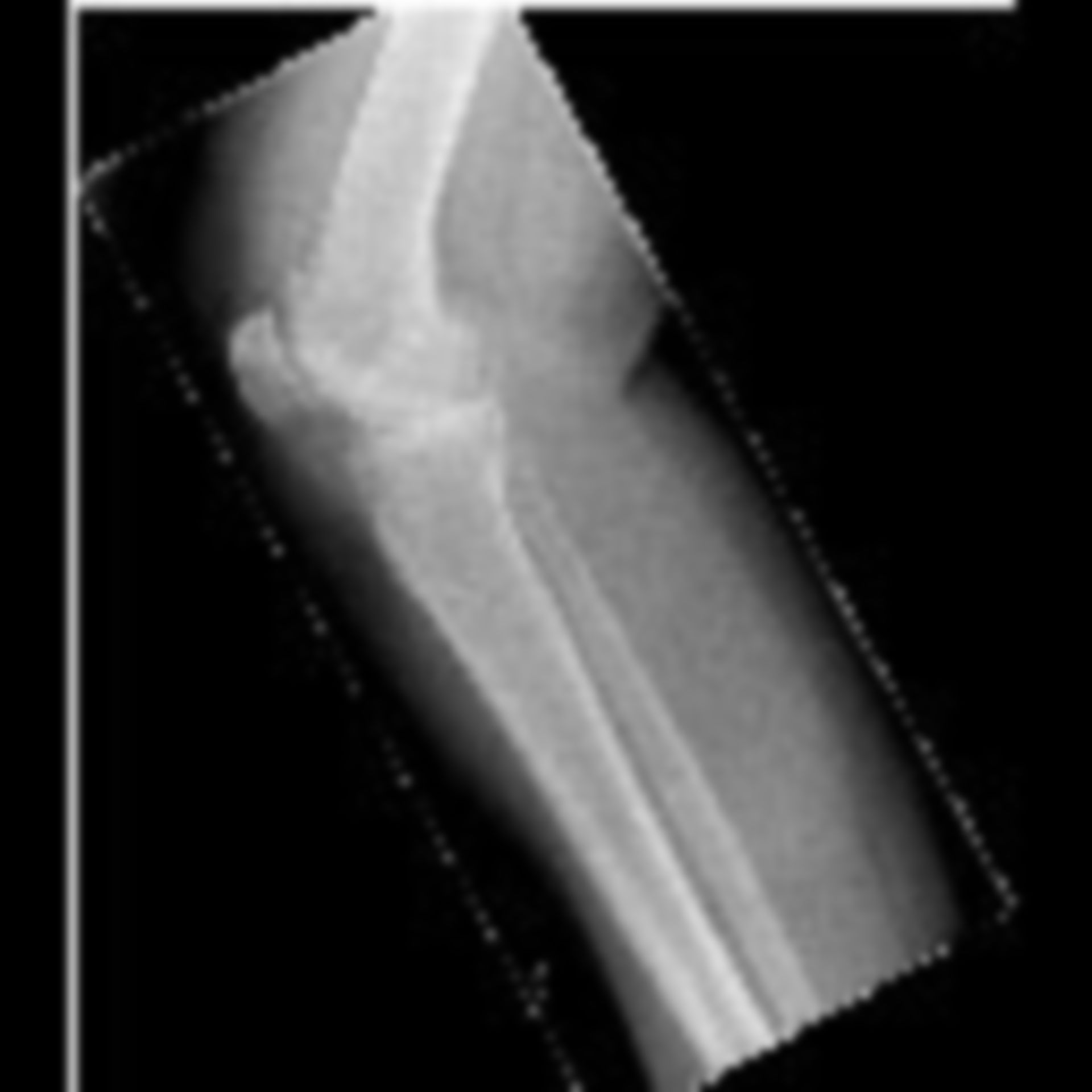Röntgen: Knie und Unterschenkel
