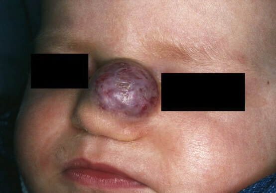 derm06_original.jpg