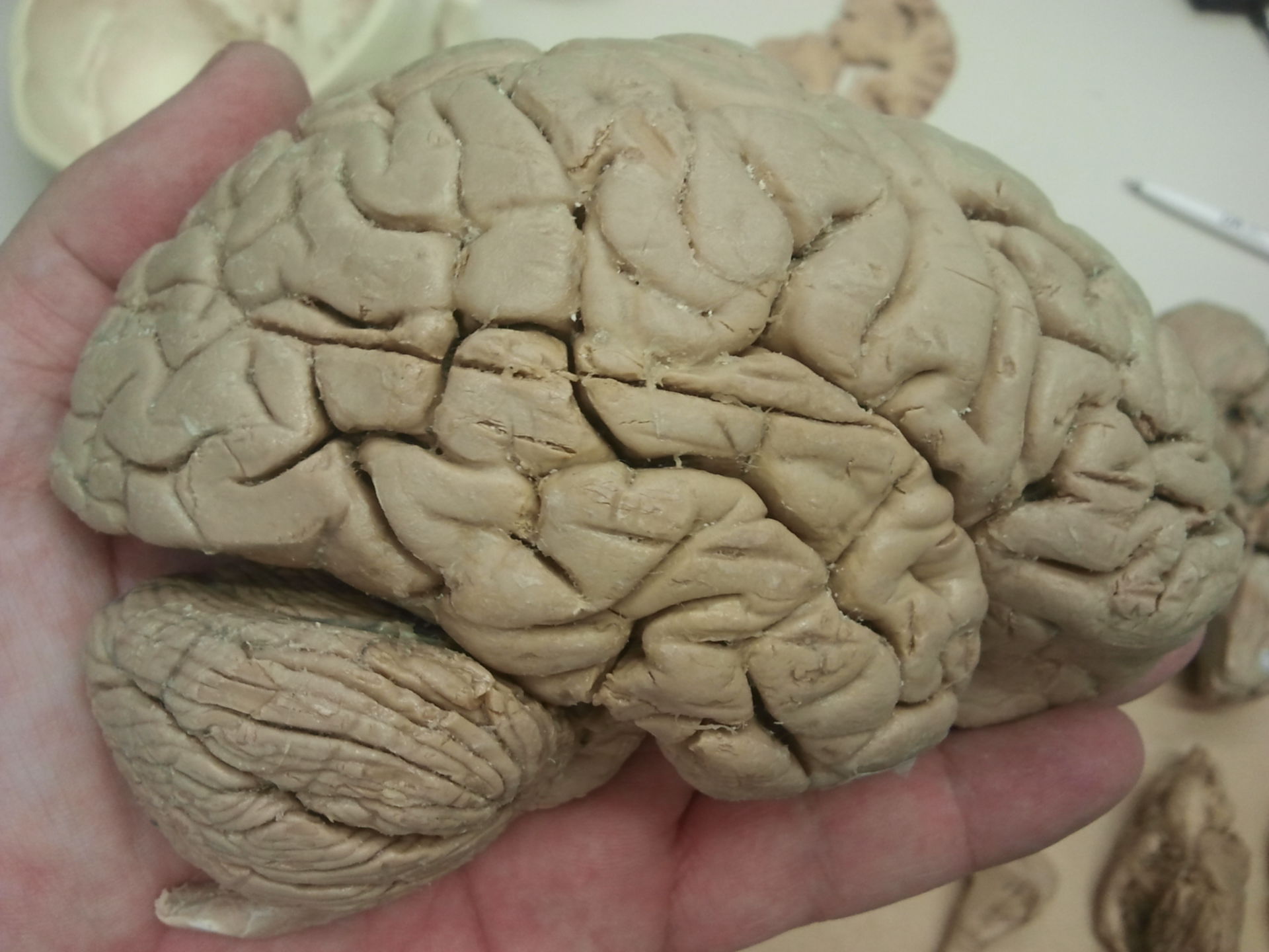 Gehirn von lateral