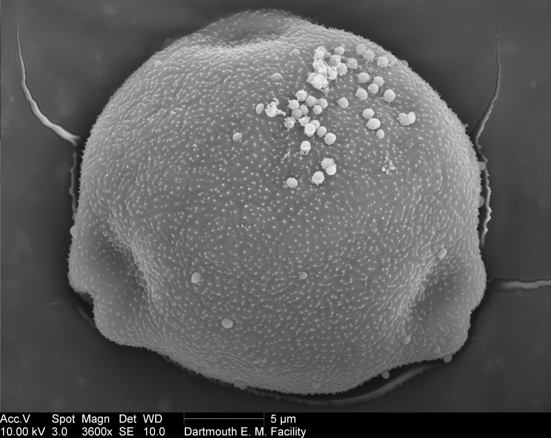Betula papyrifera (Pollen wall) - CIL:40285