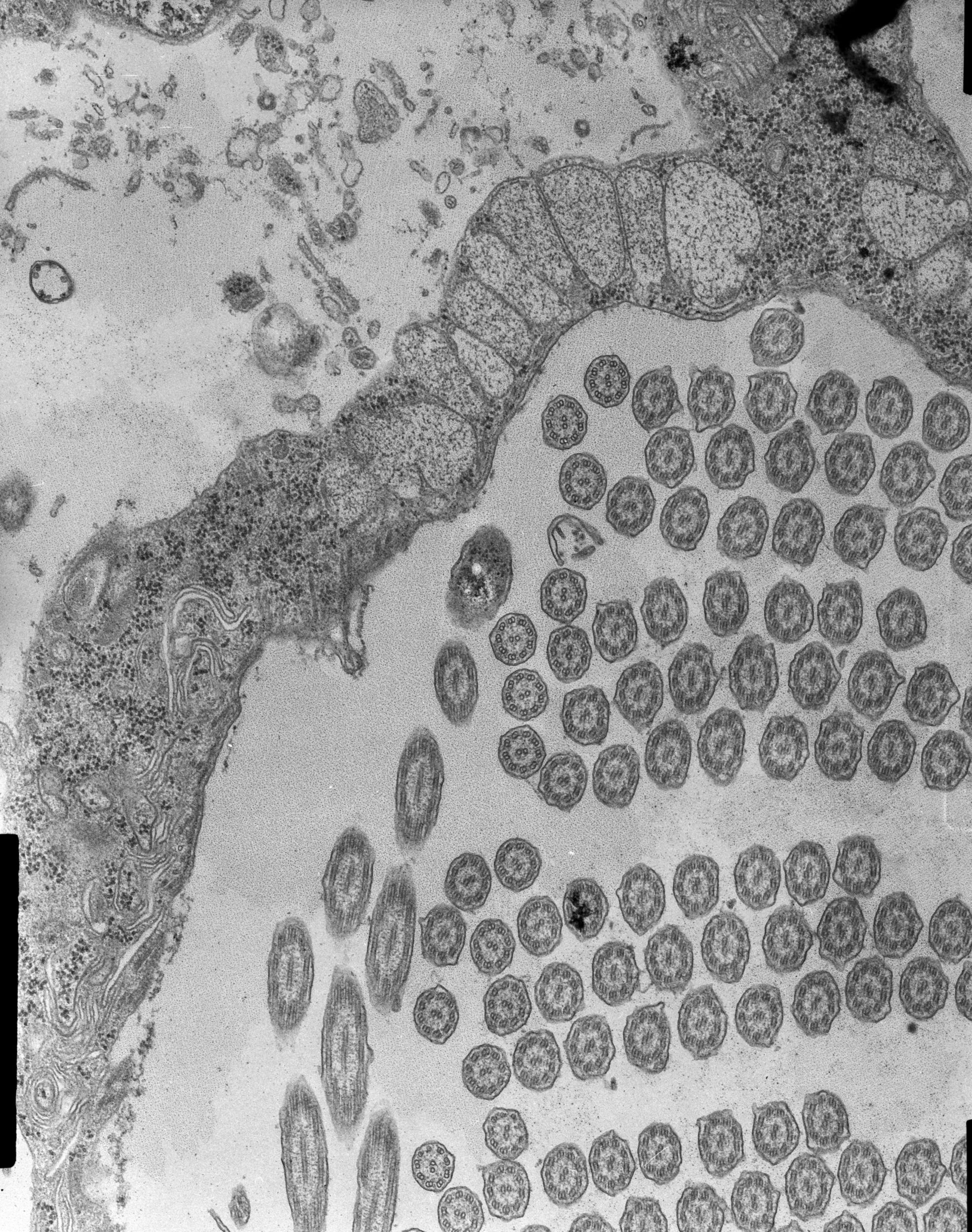 Halteria grandinella (Food vacuole) - CIL:7597