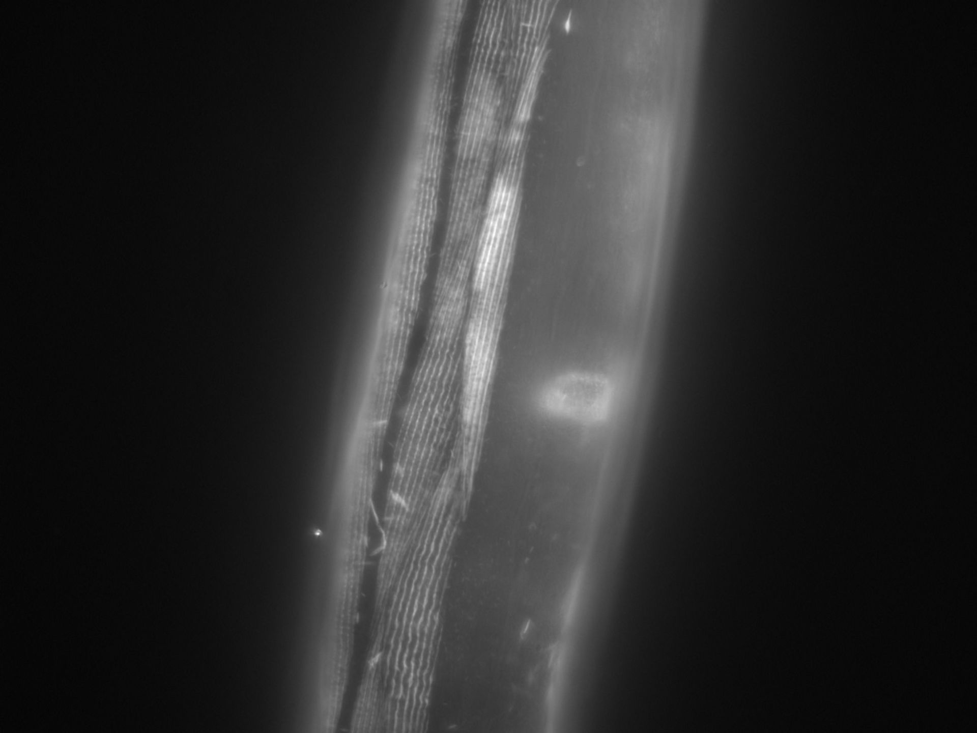 Caenorhabditis elegans (Actin filament) - CIL:1015