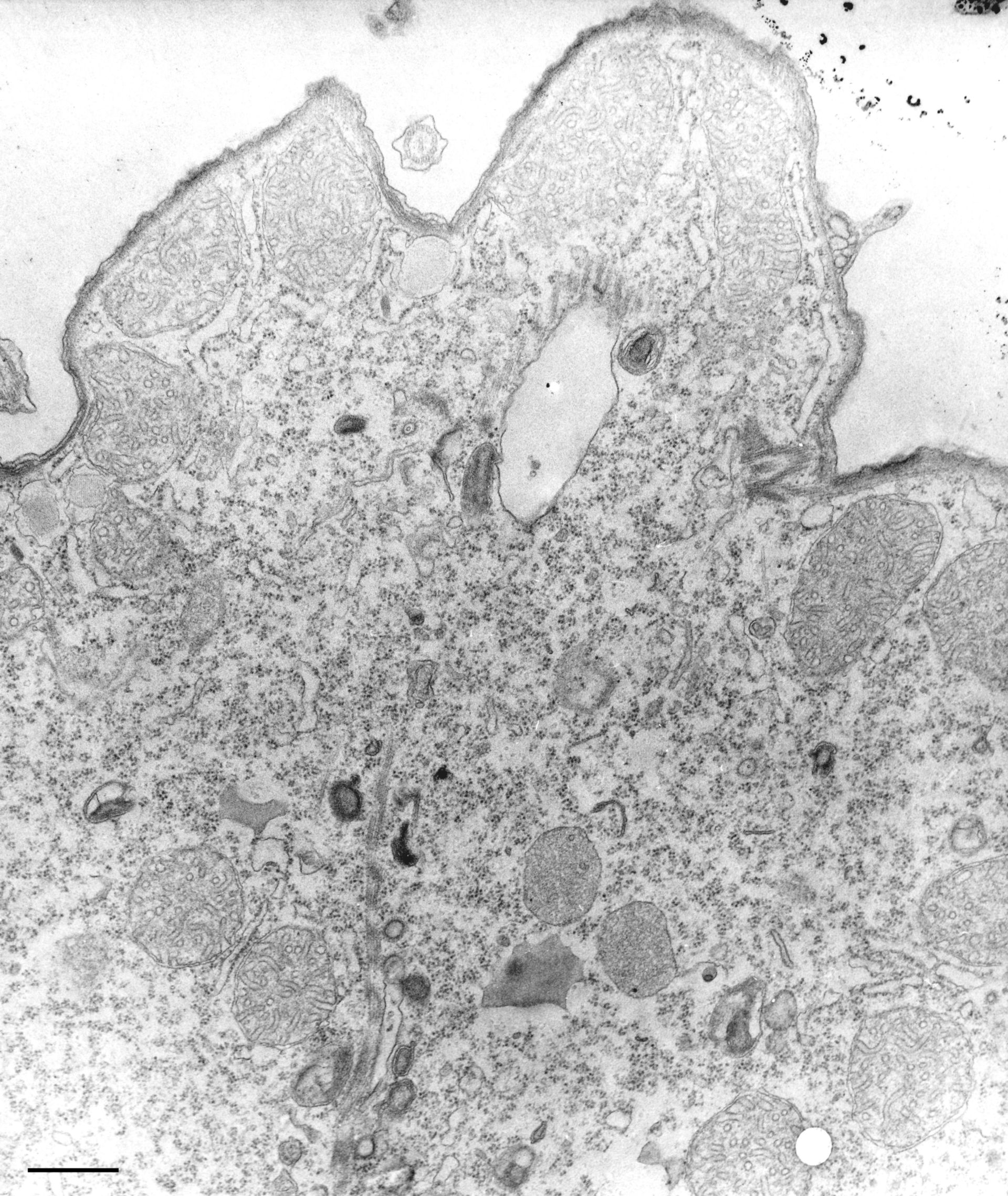 Tetrahymena pyriformis (Acidosome) - CIL:36230