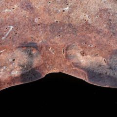 Tachypnoe DocCheck Flexikon