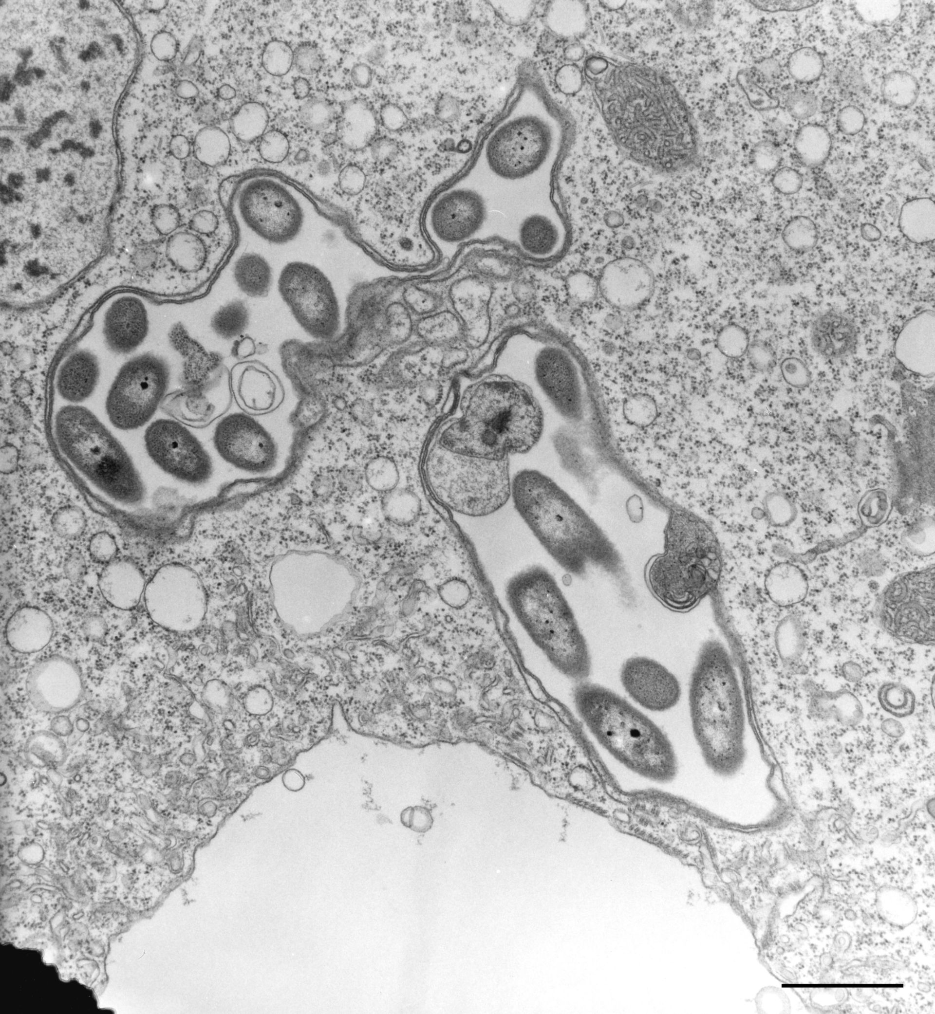 Vorticella convallaria (Microtubule associated complex) - CIL:36276