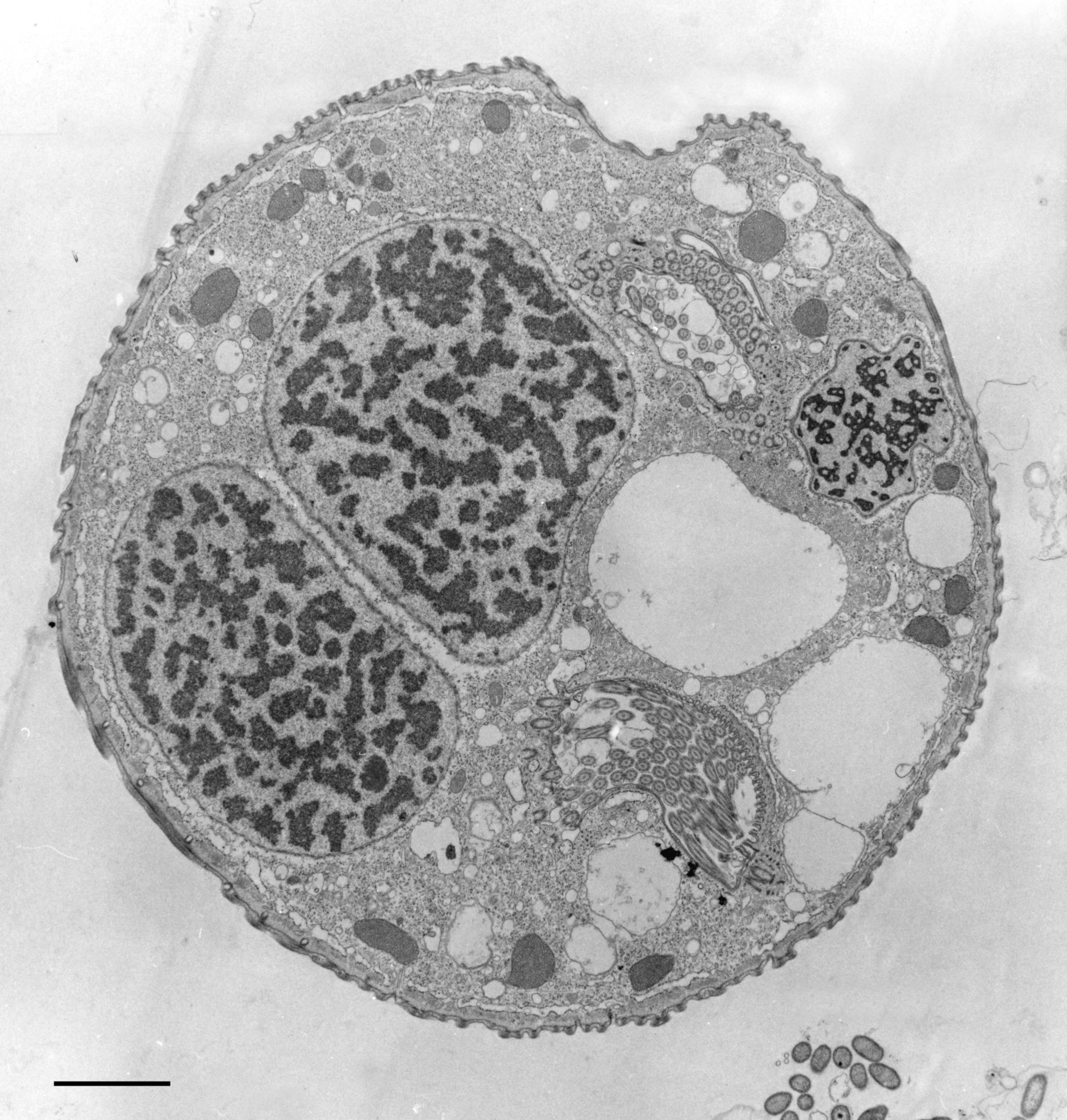 Opercularia coarctata (Micronucleus) - CIL:9809