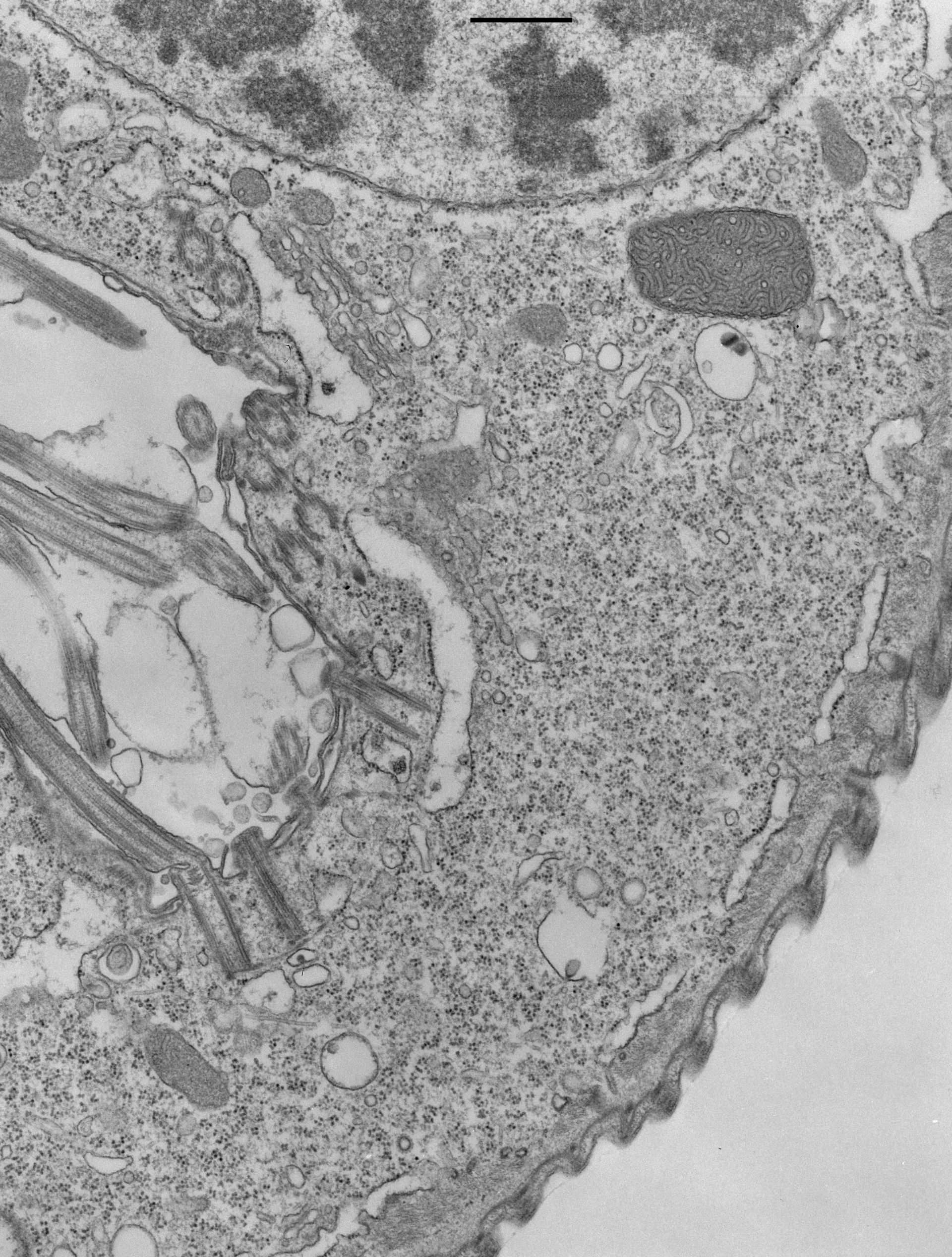 Opercularia coarctata (Golgi stack) - CIL:9912