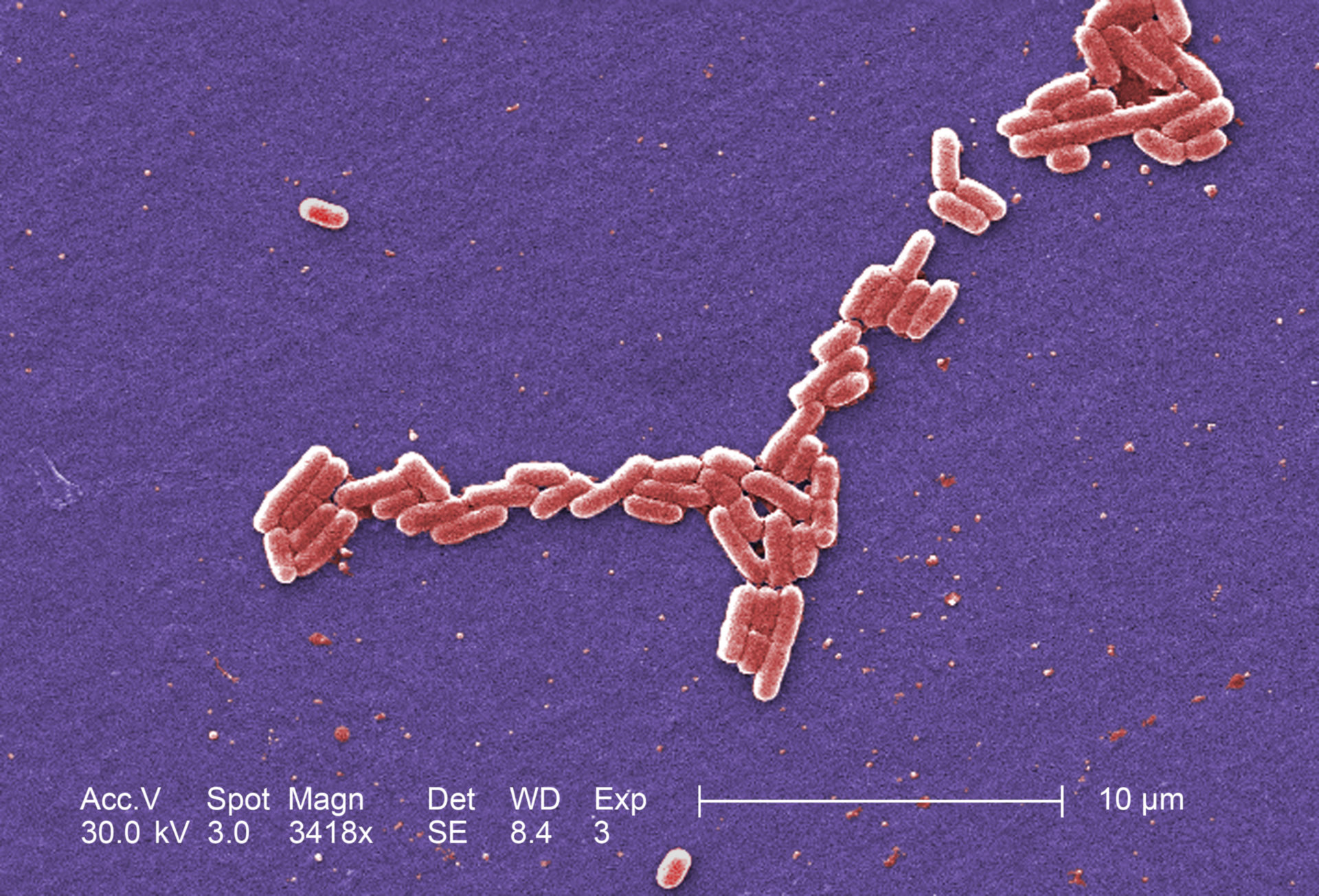 E. coli O157: H7 (REM, 3418fache Vergrößerung )