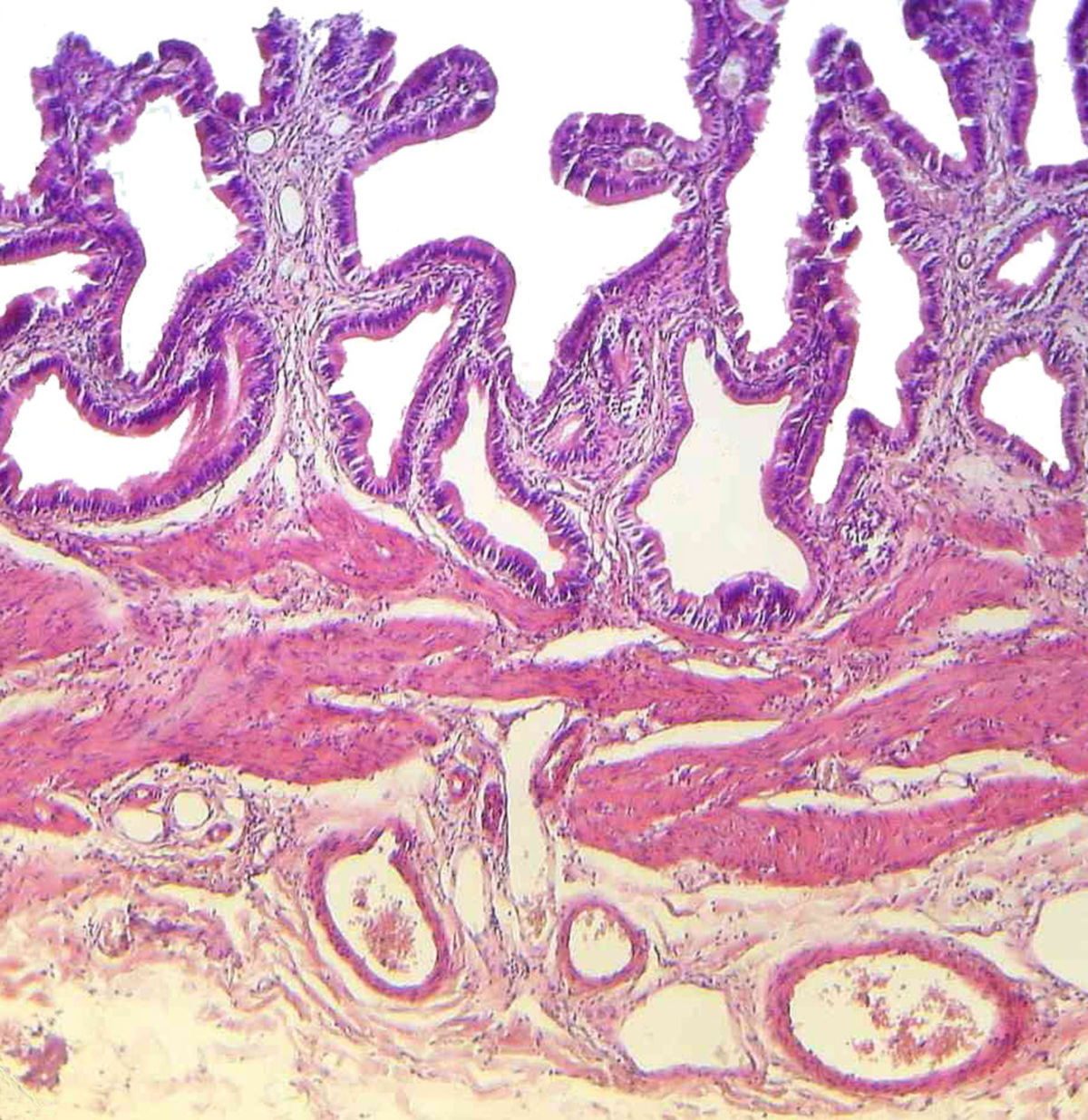 Gallenblase (Histologie)