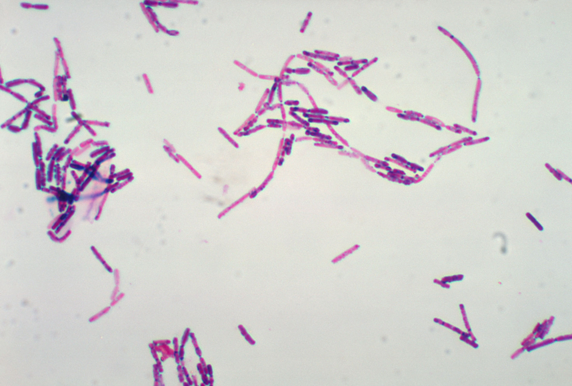 Bacillus cereus (Gramfärbung)