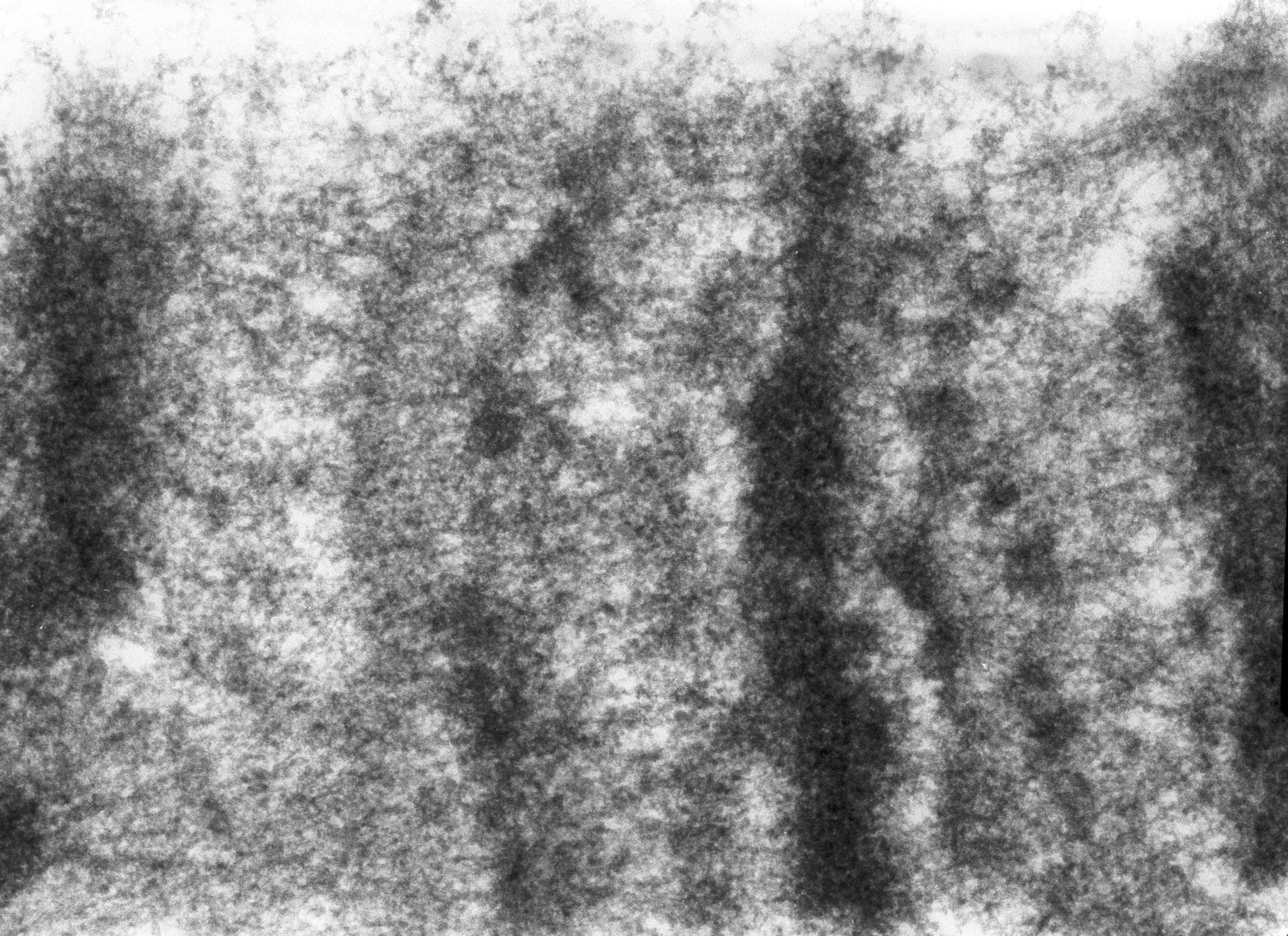 Drosophila melanogaster (Polytene chromosome) - CIL:24985