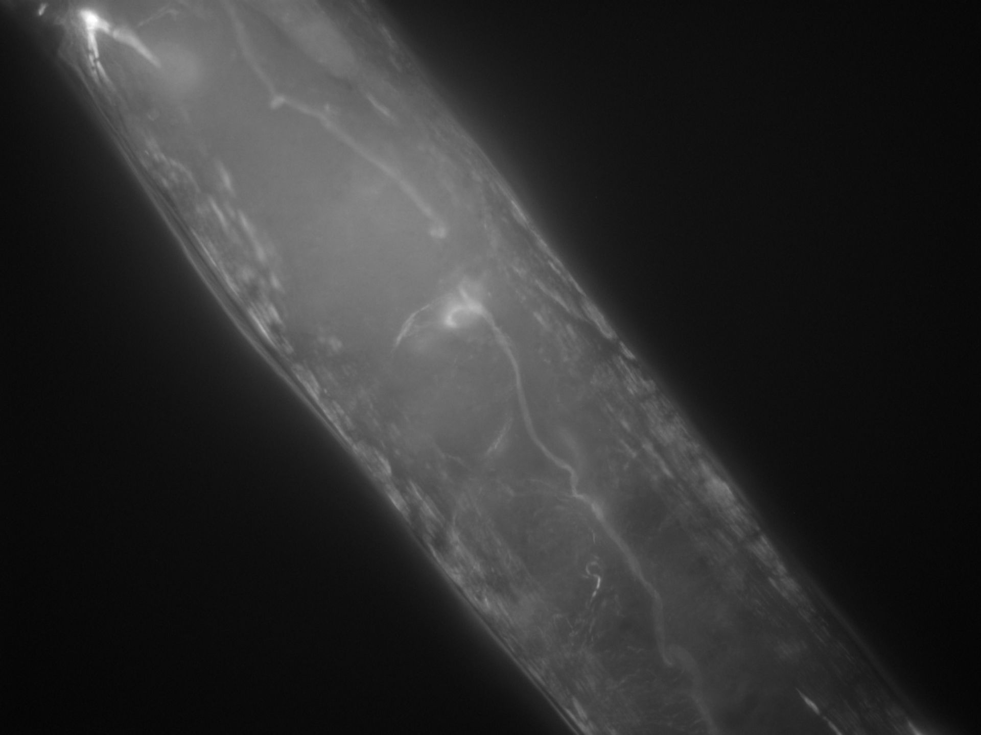 Caenorhabditis elegans (Actin filament) - CIL:1304