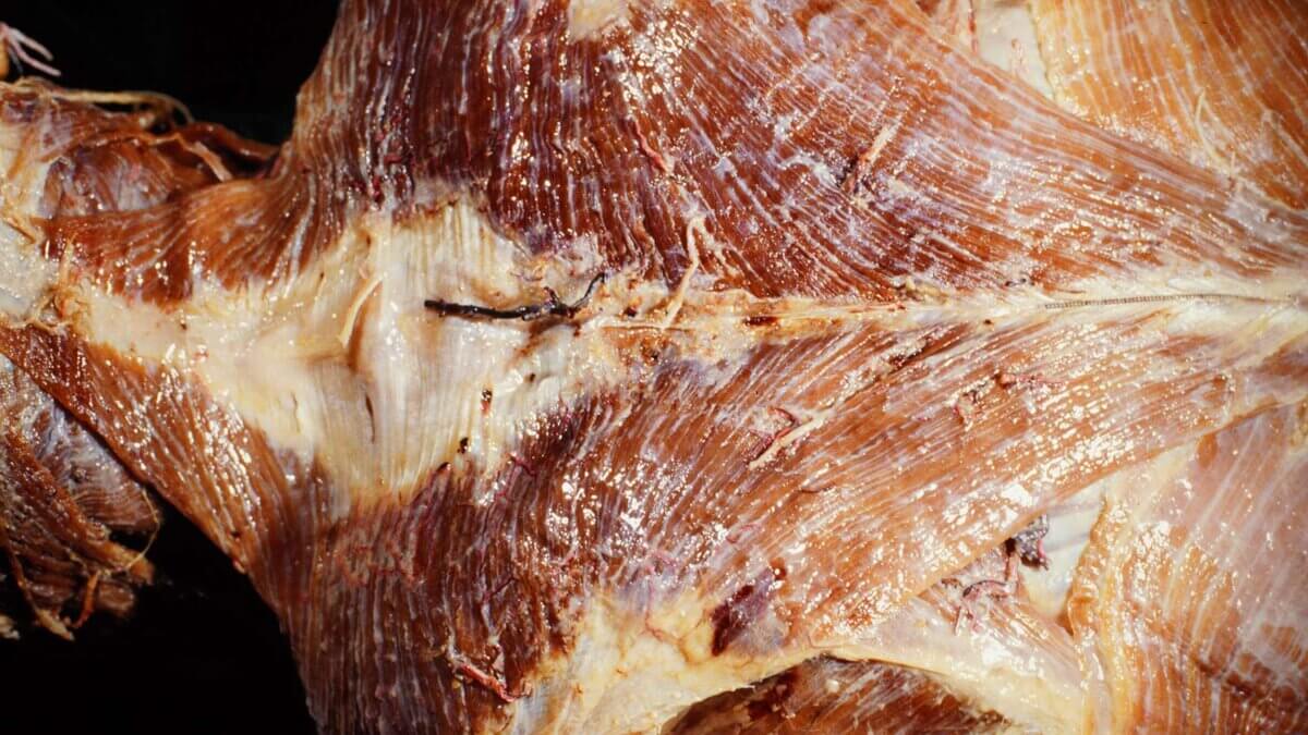 Musculus trapezius