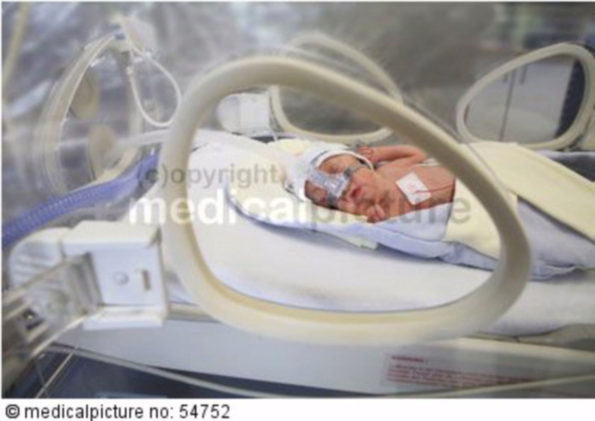 Premature baby, ICU, newborn