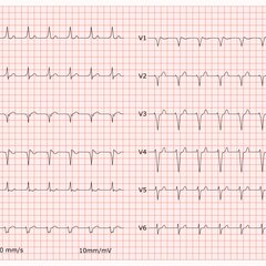 flexikon.doccheck.com