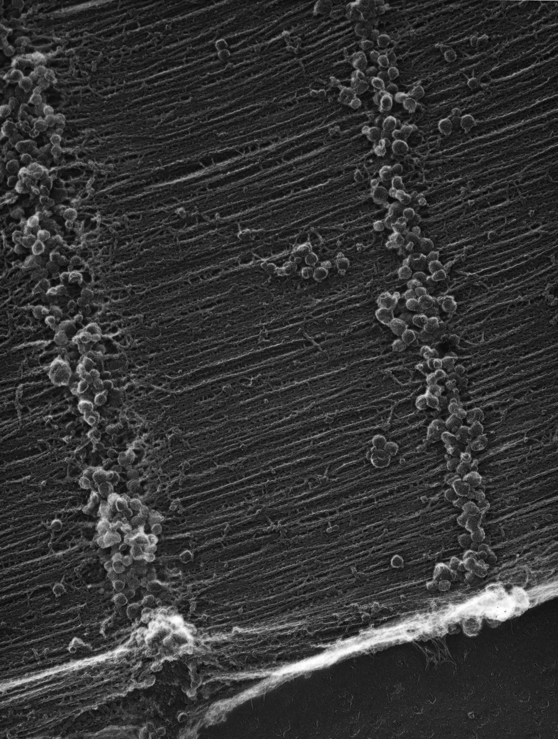Damselfly (Sarcoplasmic reticulum) - CIL:35955