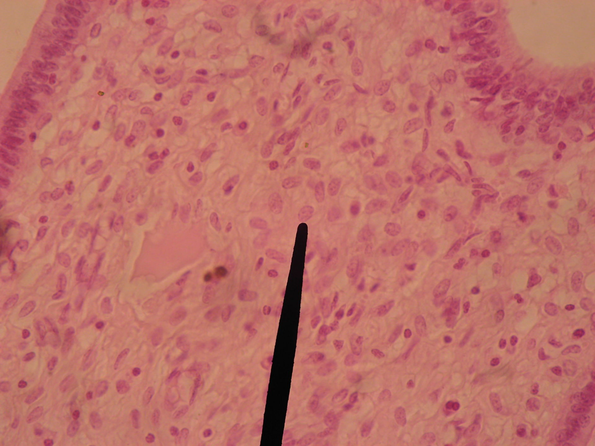 Gebärmutterhals der Zibbe (4) - Lamina propria mucosae