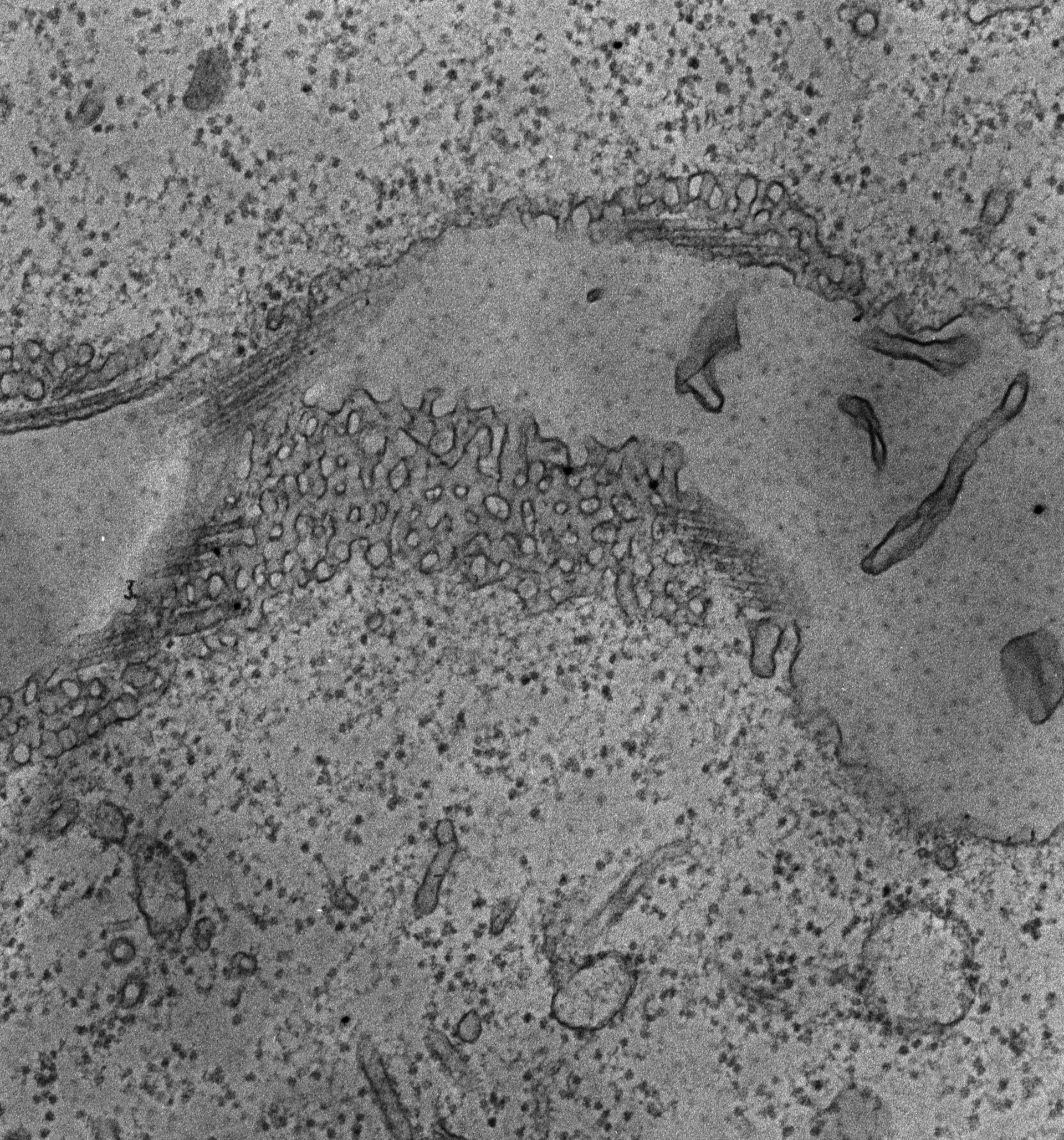 Paramecium multimicronucleatum (Cytoplasmic microtubule) - CIL:13117