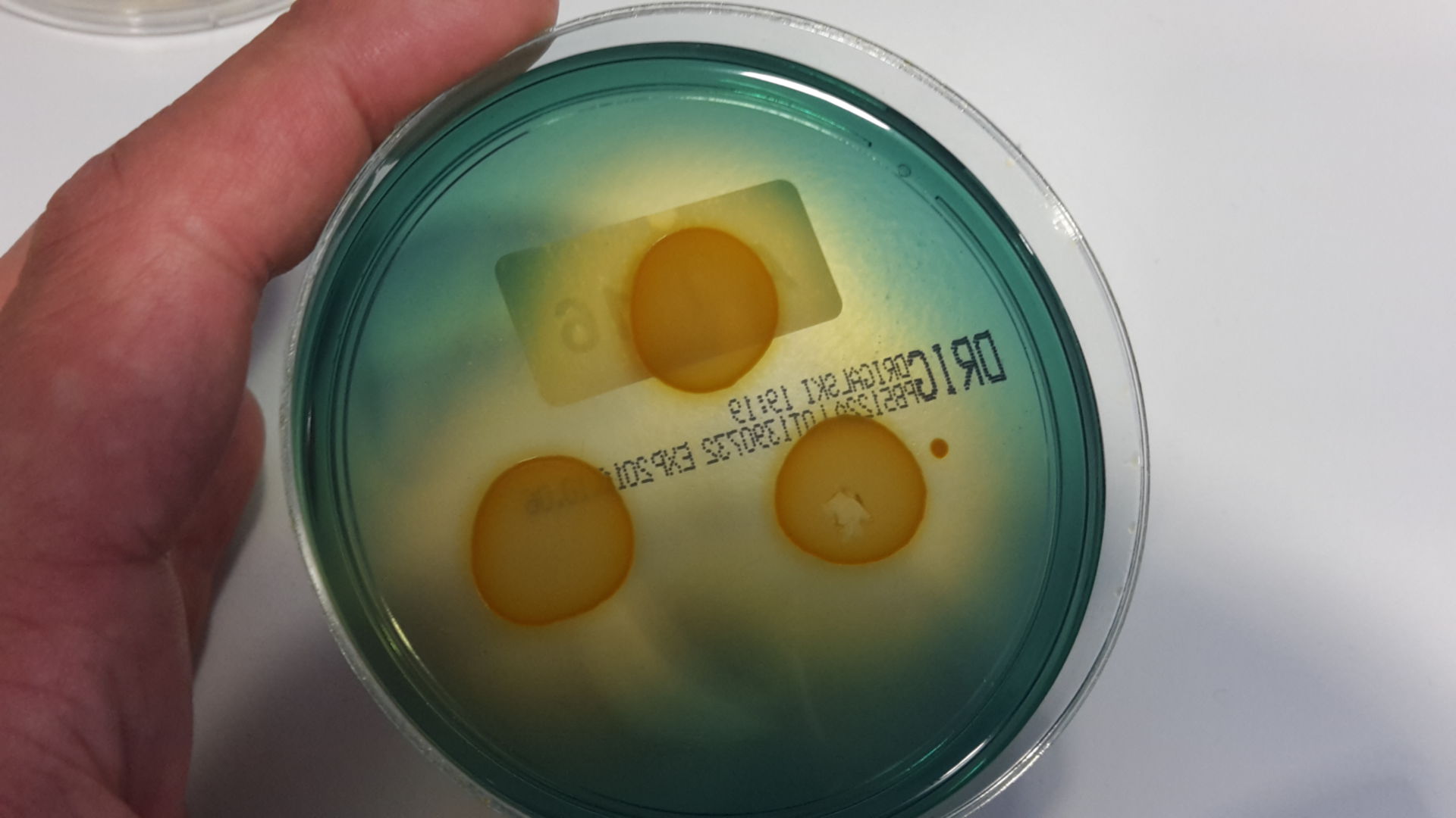 E. coli auf Drigalski Agar