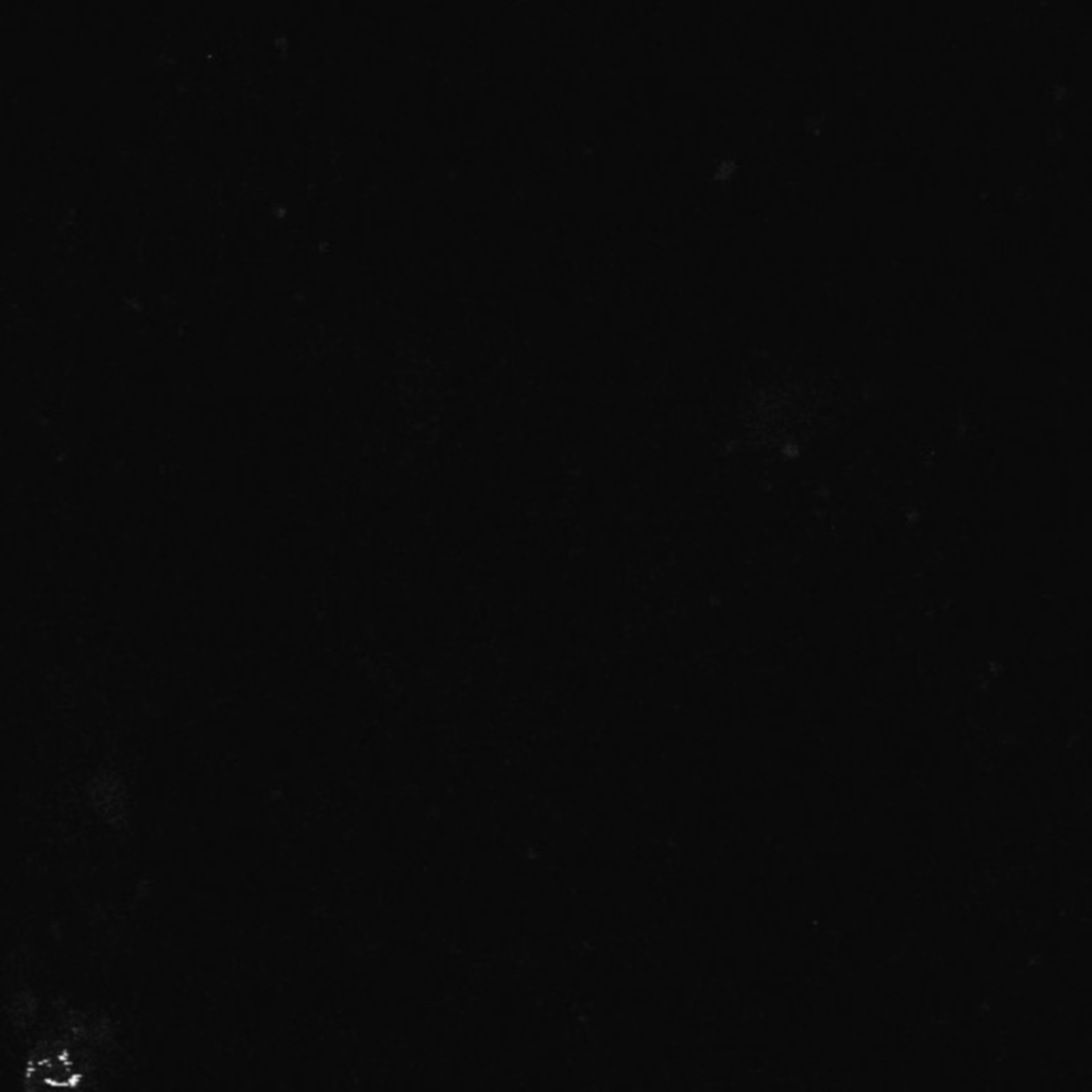 Xenopus laevis (Axon) - CIL:36916